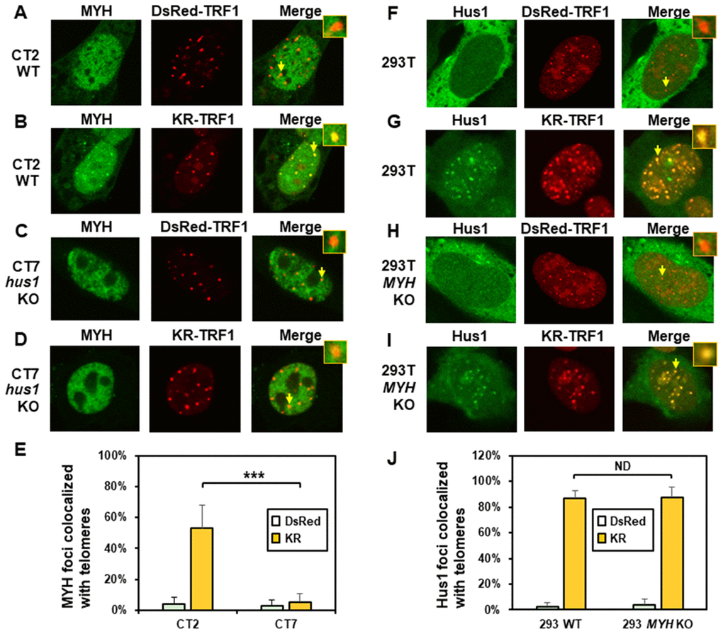 The formation of MYH foci induced at oxidatively damaged telomeres is dependent on Hus1. (A and C) GFP-MYH does not form foci at sites with DsRed-TRF1 in undamaged CT2 (hus1+/+) and CT7 (hus1-/-p21-/-) MEF cells, respectively. These cells contain granulated GFP-MYH spots and some of spots were localized with telomeres. (B and D) Damage response of GFP-MYH to the sites of KR-TRF1 after light activation in CT2 and CT7 MEF cells, respectively. GFP-MYH foci are not found at the sites of KR-TRF1 in CT7 cells. (E), Analyses of about 20 cells in each (A–D) group indicated that approximately 50% of GFP-MYH foci colocalized with telomeres in CT2 cells, in contrast, less than 5% of GFP-MYH foci colocalized with telomeres in CT7 cells. (F–J), GFP-Hus1 foci formation at telomeres in control HEK-293T and MYH KO HEK-293T human cells. Experiments were performed similarly to (A–E) except using GFP-hHus1 and different cells. After ROS induction by activating the KR protein, over 80% of GFP-Hus1 foci are colocalized with KR-TRF1 in both HEK-293T and MYH KO HEK-293T cells (J). ND indicates no difference.