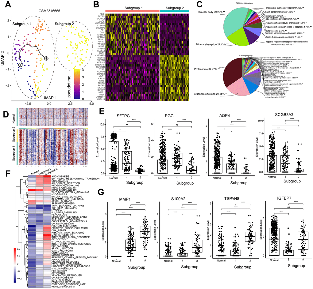 Analysis of the tumor cell subgroups in the stage IV primary LUAD sample, GSM3516665. (A) UMAP plot shows the different trajectories of two tumor cell subgroups from the GSM3516665 sample. (B) Heatmap shows the DEGs between the two tumor cell subgroups from the GSM3516665 sample. (C) Pie graphs show the results of the functional enrichment analysis of the DEGs between the two tumor cell subgroups from the GSM3516665 sample. (D) InferCNV plot shows significant copy number variations in the chromosomes of the two tumor cell subgroups from the GSM3516665 sample in comparison with the normal lung epithelial cells. (E) Heatmap shows the gene set variation analysis of the two subgroups from the GSM3516665 sample and the normal lung epithelial cells. The color code in the heat maps ranges from navy blue to red and shows progression from low to high expression of the gene sets. (F) Gene expression analysis shows that genes associated with the normal type II alveolar Type cells such as SFTPC, PGC, AQP4, and SCGB3A2 are upregulated in the subgroup 1 cells from the GSM3516665 sample. (G) Gene expression analysis shows that genes associated with tumor progression such as MMP1, S100A2, TSPAN8, and IGFBP7 are upregulated in the subgroup 2 from the GSM3516665 sample.