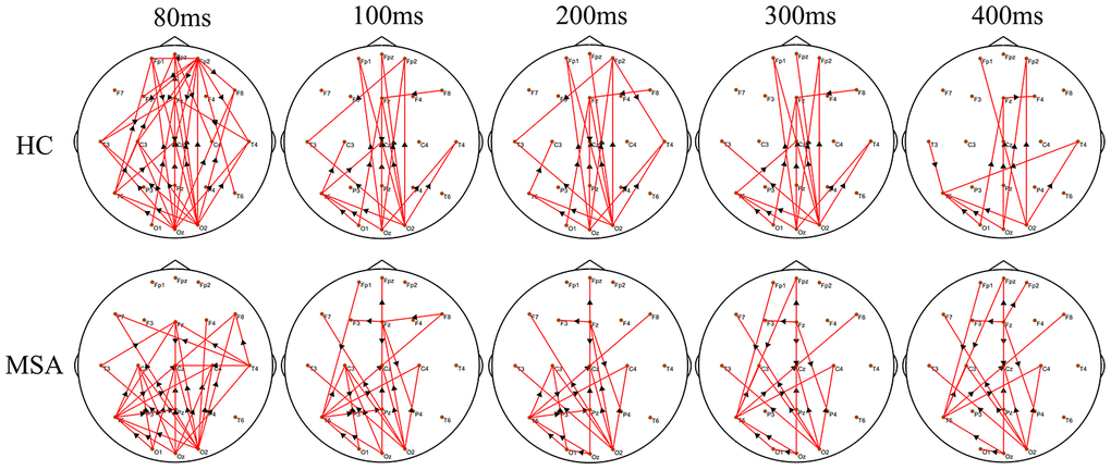 The difference in the time-varying EEG network patterns between HCs and MSA patients. Time (millisecond): after single-pulse TMS. Red lines: enhanced connections; black arrows: the direction of information flow; MSA: multiple system atrophy; HC: healthy control.
