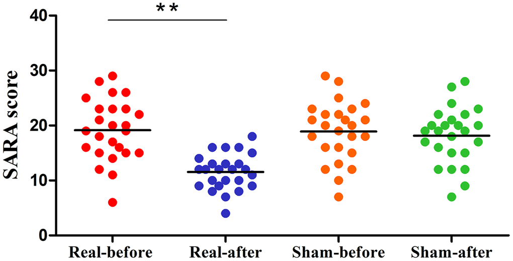 Differences in SARA scores of the pre- and post-treatment in the real rTMS and sham group separately. The real rTMS group exhibits decreases in SARA scores after treatment compared with the sham rTMS group. **P