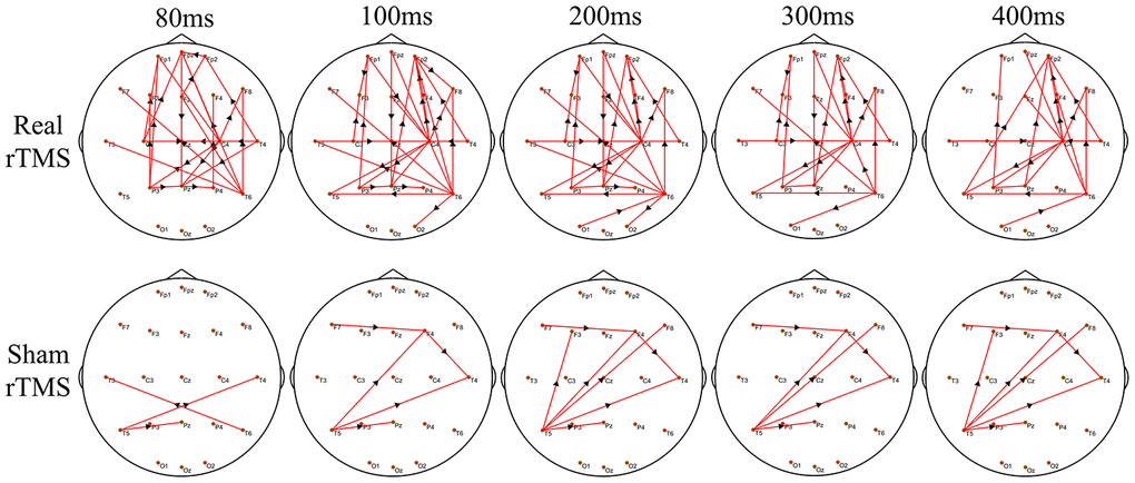 The difference in time-varying EEG network patterns between the real rTMS group and the sham group after therapy. Time (millisecond): after single-pulse TMS. Red lines: enhanced connections; black arrows: the direction of information flow; rTMS: repetitive transcranial magnetic stimulation.