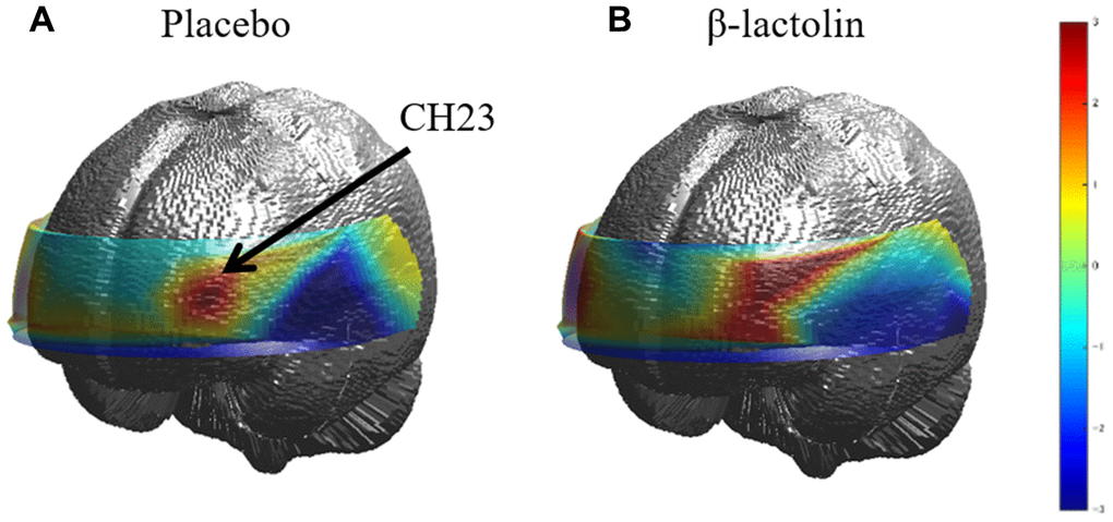 Full article: Anxiolytic effects of theaflavins via dopaminergic activation  in the frontal cortex