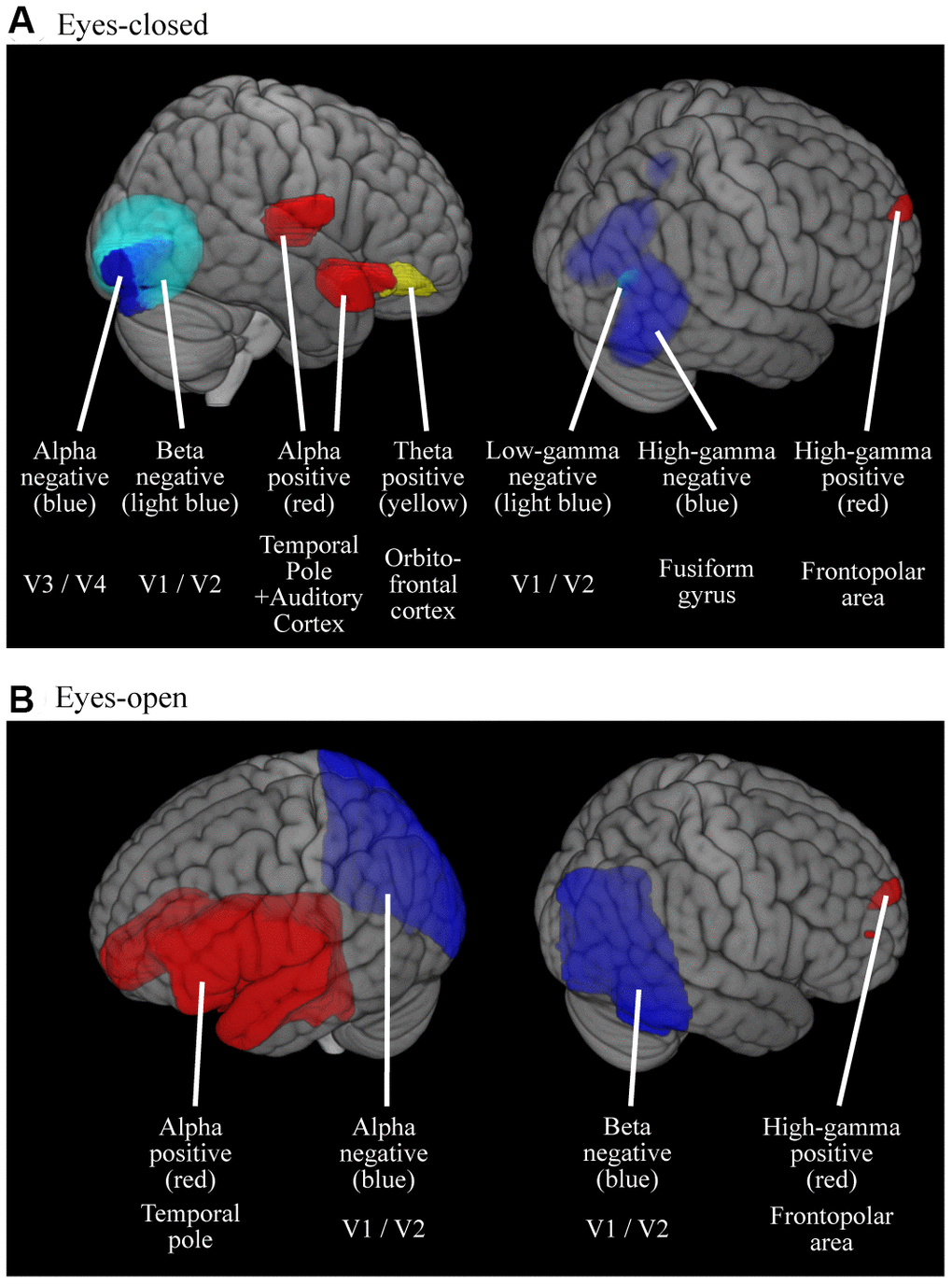 Cortical regions where the oscillatory powers were significantly predicted by age. Colored areas represent the clusters where the oscillatory powers were significantly predicted by age, either in positive- or negative-fashion (p A) Results for EC condition (B) Results for EO condition. M, Males; F, Females.
