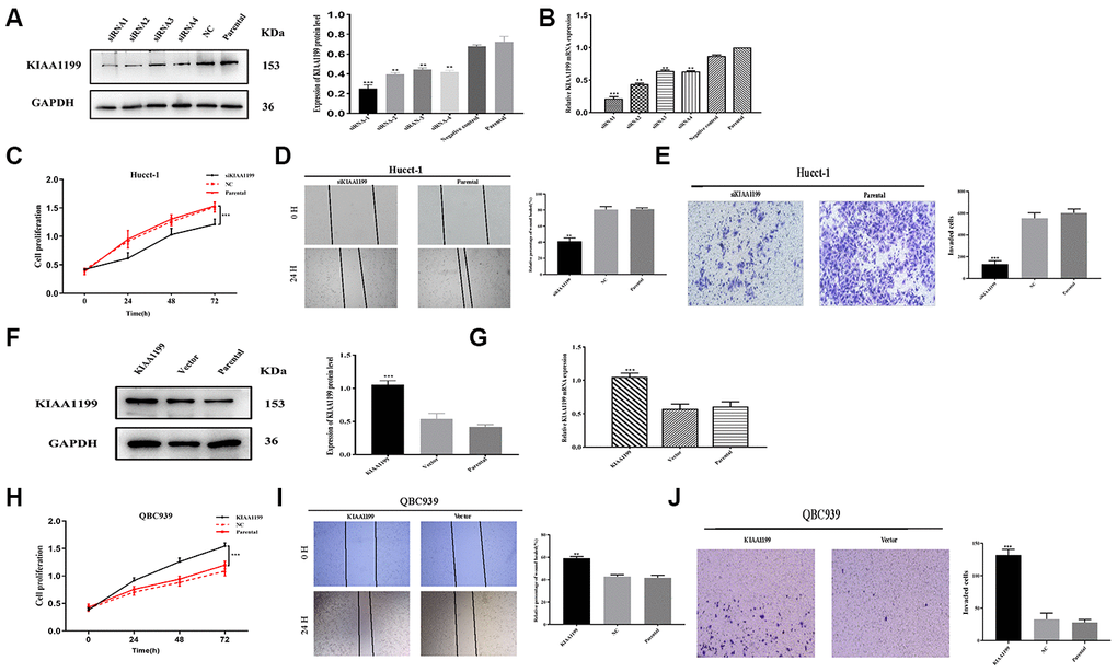 KIAA1199 regulates proliferation and invasion in CCA cell lines. (A, B) The relative protein and mRNA expression of four small interfering RNA in siKIAA1199-transfected cells compared with control and parental cells. (F, G) Overexpression of KIAA1199 in QBC939 cells with lentivirus infection was verified by western blotting and qPCR. Proliferation of Hucct-1 cells was detected with CCK-8 after silencing KIAA1199 in Hucct-1 cells (C) and overexpressing KIAA1199 in QBC939 cells (H) in normal medium with 10% FBS. Wound healing assay was applied to evaluate migration of Hucct-1 (D) and QBC939 (I). 24 h after a scratch in the cell monolayer, the wound size was measured again. Migration of Hucct-1 and QBC939 cells was assessed with transwell assay (E, J). After KIAA1199 knockdown and overexpression, cells were seeded in the upper transwell chamber and incubated for 24 h, with FBS in the lower chamber. (original magnification: ×200; scale bar, 20 μm). Data, mean ± S.D., and representative of three independent experiments.