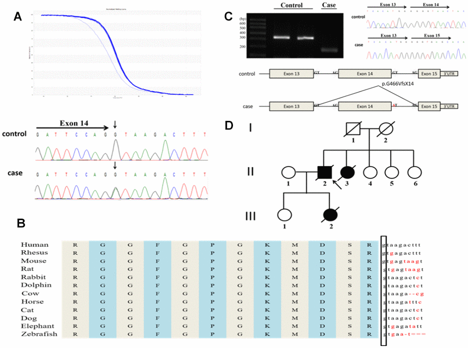 A novel splicing mutation, c.1541+1G>A in the FUS gene identified in a Chinese ALS patient. (A) The novel splicing mutation was identified by HRM analysis and direct sequencing. (B) The evolutionary conservation of the splicing mutation c.1541+1G>A are shown. (C) Minigene splicing analysis of the novel splice mutation. (D) Pedigree of the family. An arrowhead indicates the proband.