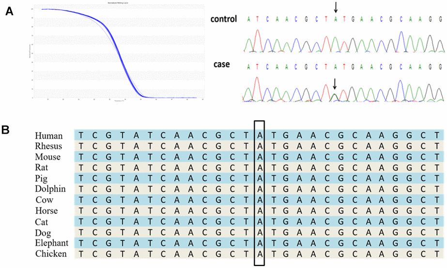 A novel 3′UTR mutation, c. *731A>G in the TARDBP gene identified in a Chinese ALS patient. (A) The novel 3′UTR mutation was identified by HRM analysis and direct sequencing. (B) The evolutionary conservation of the TARDBP 3′UTR mutation c. *731A>G.