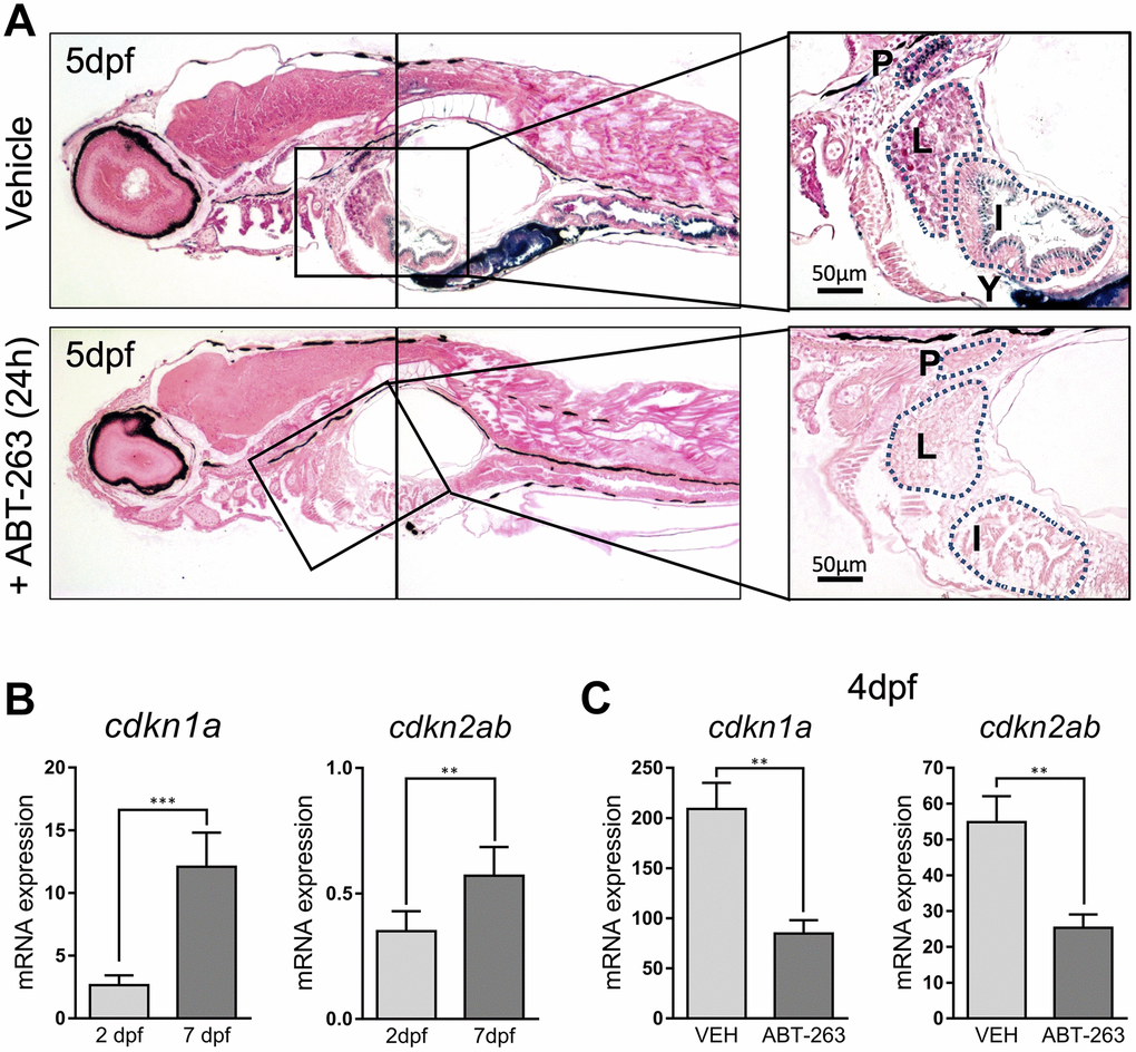 (A) Photomicrographs of whole-mounted developing zebrafish (5 dpf) stained for SA–β–gal in the absence (upper panels) or presence (lower panels) of senolytic compound ABT-263 for 24 h. Right panels show an amplified area showing a detail of positive structures. Scale bars: 50 μm. P: pronephric ducts; L: liver; I: intestine; Y: yolk. (B) Expression levels by QPCR of cdkn1a (left panel) and cdkn2ab (right panel) genes at 2 and 7 dpf relative to the housekeeping gene rps11. (C) Expression levels by QPCR of cdkn1a (left panel) and cdkn2ab (right panel) genes relative to the housekeeping gene rps11 at 4 dpf after treatment with ABT-263 or vehicle (VEH) for 48 h. Data in (B) and (C) correspond to the average ± s.d. Statistical significance was assessed by the two-tailed Student’ s t-test: *** p 