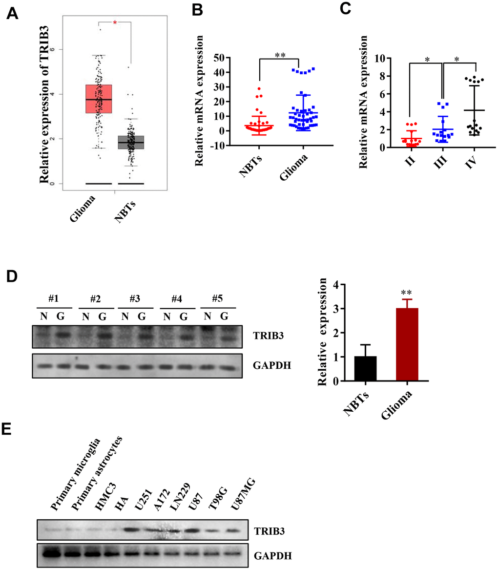 TRIB3 is upregulated in human GBM. (A) The expression level of TRIB3 from the TCGA database. (B) Q-PCR analysis of TRIB3 mRNA levels in glioma tissues (n = 48) and neighboring tissues (NBTs, n = 48). (C) Q-PCR analysis of TRIB3 mRNA levels in different grades of glioma. (D) The protein expression level of TRIB3 in glioma tissues and NBTs. (E) The protein expression level of TRIB3 in different normal brain cells and glioma cell lines. *p