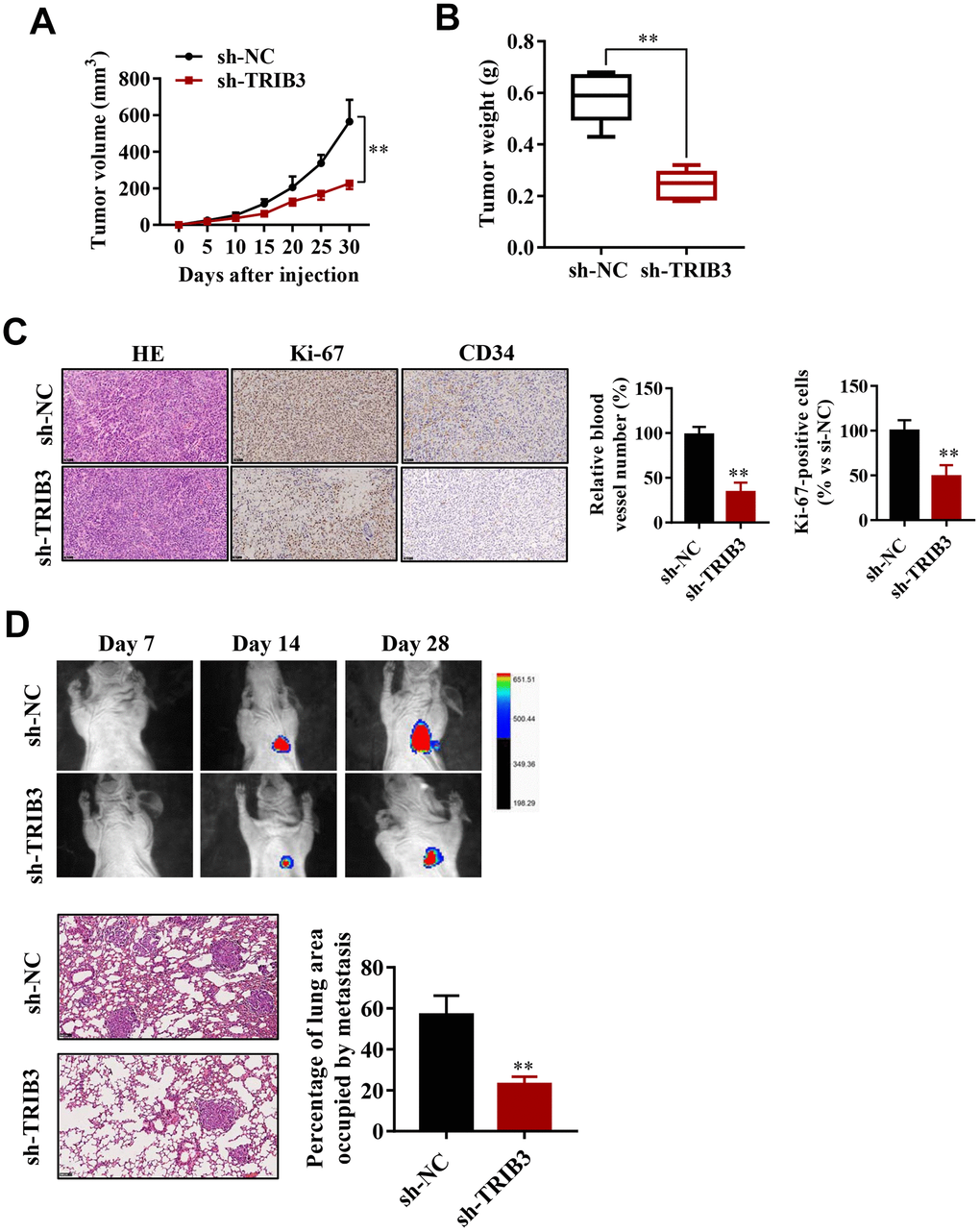 TRIB3 promotes glioma growth and metastasis in vivo. (A) Quantitative analysis of the tumor volume at the indicated times. (B) Quantitative analysis of the tumor weight. (C) HE staining and Ki-67 and CD34 immunohistological staining of tumors derived from scramble and sh-TRIB3 cells. (D) In vivo bioluminescent imaging of nude mice at days 7, 14, and 28 post-GBM cell implantation. Quantification of luminescence signal intensity on days 7, 14, and 28 after implanting the GBM cells. *p