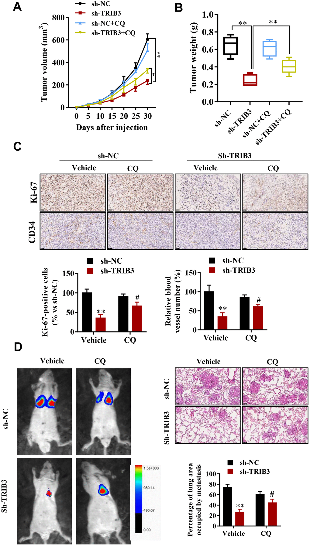 TRIB3 deficiency enhances autophagy and impairs the malignant progression of GBM in mice. (A, B) Tumor weight and volume in the sh-NC and sh-TRIB3 or sh-NC+CQ, sh-TRIB3+CQ groups. (C) Histological chemistry staining of Ki-67 and CD34 to measure the proliferation and angiogenesis of GBM cells in the sh-NC and sh-TRIB3 or sh-NC+CQ, sh-TRIB3+CQ groups. (D) Representative mice injected with modified sh-TRIB3- or sh-NC-expressing GBM cells. Downregulation of TRIB3 decreased lung metastases. *p#p