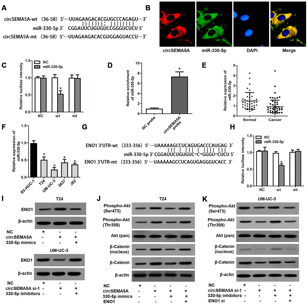 CircSEMA5A serves as a miRNA sponge for miR-330-5p to upregulates ENO1 expression. (A) Diagram showed the potential binding site of miR-330-5p in circSEMA5A sequence. (B) Co-localization of circSEMA5A and miR-330-5p by FISH assays. (C) Luciferase reporter assay verified the predicted binding site between miR-330-5p and circSEMA5A. (D) The level of miR-330-5p pulled-down by circSEMA5A probe was analyzed by qRT-PCR. (E) The relative expression of miR-330-5p was detected by qRT-PCR in BC tissues and paired normal bladder tissues. (F) The relative expression of miR-330-5p was detected by qRT-PCR in BC cell lines and a normal human uroepithelial cell line. (G) Diagram showed the potential binding site of miR-330-5p in ENO1 3’UTR. (H) Luciferase reporter assay verified the predicted binding site between miR-330-5p and ENO1 3’UTR. (I) T24 cells were transfected with circSEMA5A overexpression plasmids and miR-330-5p mimics and UM-UC-3 cells were transfected with circSEMA5A siRNAs and miR-330-5p inhibitors, and ENO1 expression was detected by western blot assay. (J and K) Activations of Akt and β-catenin signaling pathways were evaluated by western blot assay. Data are presented as mean ± SD. *P 