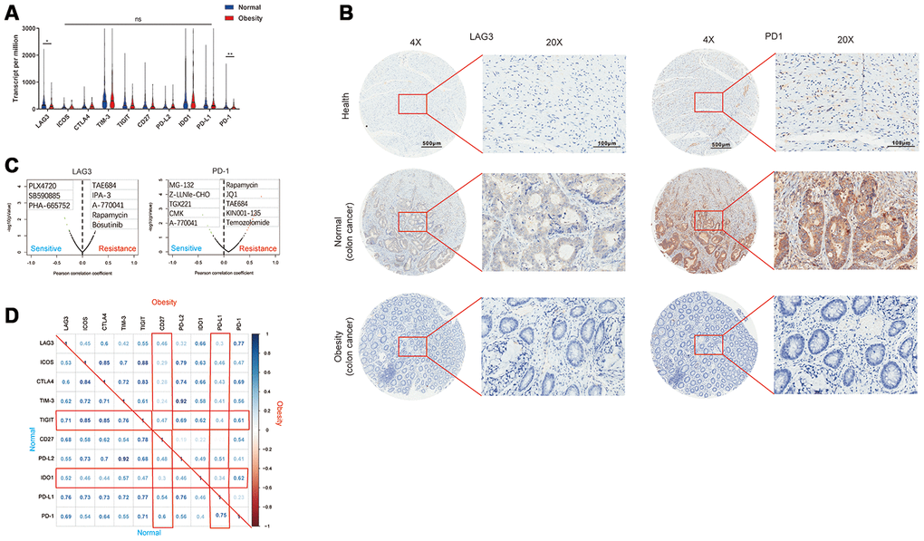 Obesity was associated with repression of immune checkpoints. (A) The expression of various immune checkpoints in obesity and normal groups. (B) The expression of LAG3 and PD-1 in healthy bowel tissues, colon cancer derived from normal (non-obesity) patients and obesity patients was confirmed by immunohistochemistry. (C) The association of drug sensitiveness and gene expression (LAG3 and PD-1) analyzed by Genomics of Drug Sensitivity in Cancer (GDSC) database. (D) The correlation matrix of each immune checkpoint in obesity and normal group. (*p**p