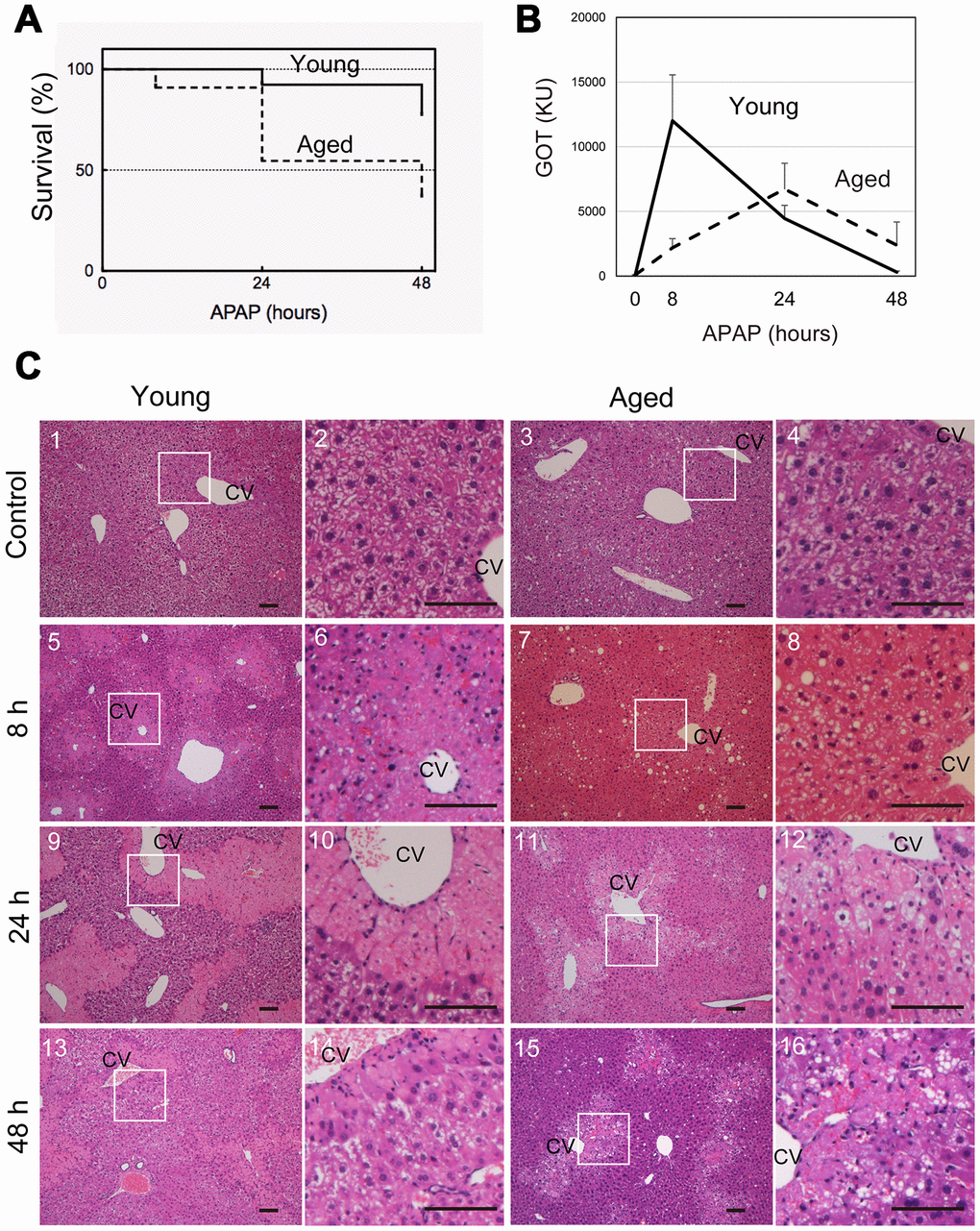 Aged mice are more susceptible to acetaminophen-induced liver injury. (A) Increased mortality by APAP injury in aged mice. Young (8-10W) and aged (>80W) mice were intraperitoneally injected with 300 mg/kg acetaminophen. N = 8 and 6 for young and aged mice, respectively. (B) Tissue damage is sustained at 48 hours after APAP injury in aged mice. Serum GOT increases at 8 hours after APAP administration, gradually decreases, and then gets back to the normal levels at 48 hours in young mice (solid line). By contrast, GOT is low at 8 hours and increases by 24 hours in aged mice (dotted line). GOT is still high at 48 hours. Serum was collected from more than six mice at each time point, and average values with SEMs are presented. (C) Histological analysis of young and aged liver tissue during APAP injury. APAP induces hepatocyte necrosis around CV, where hepatocytes lose their nuclei, and their cytoplasm is pale red with eosin staining (panels 5 and 6, 9 and 10). The damaged region is smaller at 48 hours after injury (panels 13 and 14). Contrastingly, in aged liver tissue, damaged areas are not clear at 8 hours (panels 7 and 8), become noticeable with pale eosin staining at 24 hours (panels 11 and 12), and persist at 48 hours (panels 15 and 16). Boxes in panels 1, 3, 5, 7, 9, 11, 13, and 15 are enlarged in panels 2, 4, 6, 8, 10, 12, 14, and 16, respectively. Bars represent 100 μm.