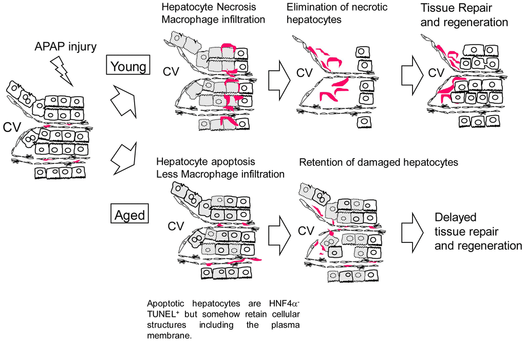 Model for the responses against APAP injury in young and aged mice. In young mice, APAP induces hepatocyte necrosis around the CV. Necrotic hepatocytes are eliminated by infiltrated macrophages, which is followed by hepatocyte proliferation. In aged mice, APAP induces hepatocyte apoptosis. Apoptotic hepatocytes are HNF4α-TUNEL+ but somehow retain cellular structures including the plasma membrane even at 24 h after the injury, suggesting they are slowly dying. In addition, macrophages are not efficiently recruited to the damaged tissue containing apoptotic hepatocytes. Consequently, the clearance of nonfunctional hepatocytes is delayed and the subsequent hepatocyte proliferation is suppressed in aged mice.