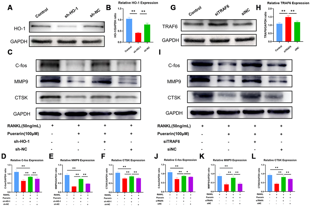 Puerarin inhibits ROS levels by upregulating HO-1 and downregulating TRAF6. (A) Representative western blot images show the HO-1 protein levels in the control and HO-1 knockdown RAW264.7 cells. (B) The histogram plots show the relative HO-1 levels in the control and HO-1 knockdown RAW264.7 cells. Note: n=3 per group; **P 0.01. (C) Representative western blots show the levels of C-fos, MMP9 and CTSK in the control and HO-1 knockdown RAW264.7 cells treated with RANKL or RANKL+puerarin. (D–F) The histogram plots show the levels of C-fos, MMP9 and CTSK proteins in the control and HO-1 knockdown, RAW264.7 cells treated with RANKL or RANKL+puerarin. Note: n=3 per group, **P 0.01. (G) Western blot analysis shows the TRAF6 protein levels in the control and TRAF6 overexpressing RAW264.7 cells. (H) The histogram plots show the relative TRAF6 protein levels in the control and TRAF6 overexpressing RAW264.7 cells. Note: n=3 per group; **P 0.01. (I) Representative western blots show the levels of C-fos, MMP9 and CTSK in the control and TRAF6 overexpressing RAW264.7 cells treated with RANKL or RANKL+puerarin (J–L) The histogram plots show the levels of C-fos, MMP9 and CTSK proteins in the control and TRAF6 overexpressing RAW264.7 cells treated with RANKL or RANKL+puerarin. Note: n=3 per group; *P 0.05, **P 0.01.