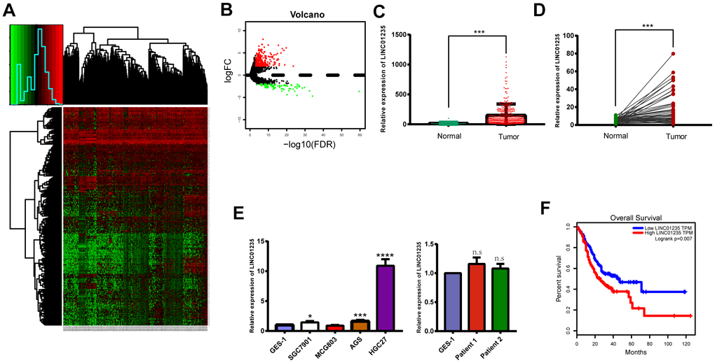 LINC01235 is significantly upregulated in GC tissues and cell lines. (A) Heatmap of TCGA-counts data. (B) Volcano plot of significance of gene expression. The x-axis shows significance by the -log10 transformed p-value number and the y-axis shows the gene expression difference. A gene is considered significantly differentially expressed if its |log (FC)| > 2 and the p-value C) GC tissues and adjacent normal tissues from TCGA, (D) 48 pairs of GC tissues and adjacent normal tissues, and (E) normal cell lines, GC cell lines and normal tissues. (F) Overall survival of GC patients from TCGA database. Data are presented as the mean ± SD. *, ** and ***: P 