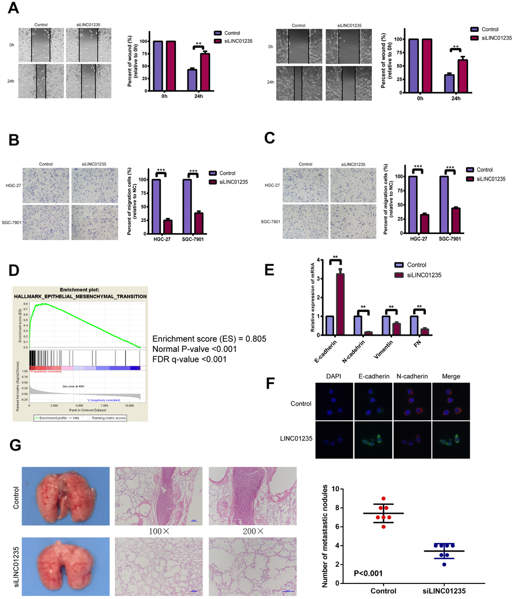 LINC01235 affects gastric cancer metastasis in vitro and vivo. (A) Wound-healing percentages at 24 h were largely inhibited in LINC01235-depleted HGC-27 and SGC-7901 cells, compared with control. In (B) migration and (C) Matrigel invasion assays, the number of migrated cells significantly decreased in LINC01235-silenced HGC-27 and SGC-7901 cells, compared with the control. (D) GSEA shows that LINC01235 may have a vital function in EMT. (E) RT-qPCR analyses of effects of LINC01235 depletion on expression of EMT-related genes in HGC-27 cells. (F) Immunofluorescence assay shows the expression of EMT in control/LINC01235-silenced cells. Green indicates E-cadherin and red indicates N-cadherin. (G) Representative tumor nodules in lungs of nude mice that were intravenously injected with control and LINC01235-silenced HGC-27 cells. Results are expressed as means ± SD. ** and ***: P 