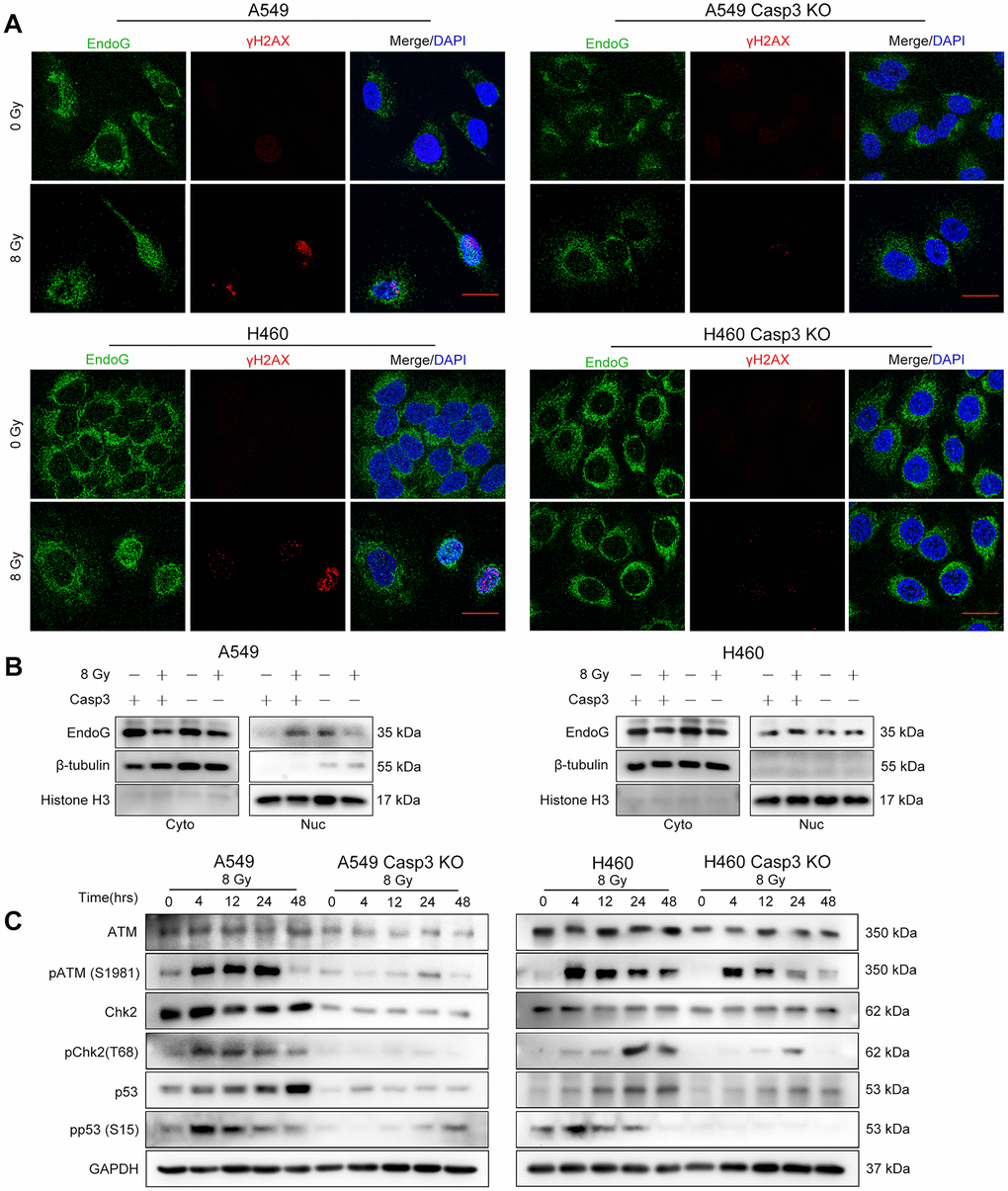 Casp3 KO attenuates the DDR via ATM/p53 signaling in irradiated NSCLC cells. (A) Immunofluorescence analysis of 8 Gy-irradiated wild-type and Casp3 KO NSCLC cells co-stained for EndoG and γH2AX foci at 48 h. Scale bars: 25 μm. (B) Western blot analysis of EndoG in the cytoplasmic and nuclear fractions of 8 Gy-irradiated wild-type and Casp3 KO NSCLC cells at 48 h. β-tubulin and Histone H3 were used as cytoplasmic and nuclear loading controls, respectively. (C) Levels of DNA damage response (DDR)-related proteins ATM, pATM (S1981), Chk2, pChk2 (T68), p53, and pp53 (S15) were measured by western blotting at indicated times after 8 Gy irradiation of wild-type and Casp3 KO NSCLC cells. GAPDH was used as the loading control.
