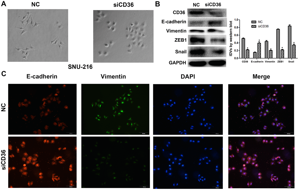 CD36 knockdown inhibits EMT in GC cells. (A) Morphological changes in SNU-216 cells transfected with NC/siCD36 (phase contrast microscopy, 200×). (B) Western blot analysis of EMT markers in SNU-216 cells transfected with NC/siCD36. Data are presented as the mean ± SD. GAPDH was used as endogenous control. (C) Immunofluorescence staining for E-cadherin and vimentin in SNU-216 cells transfected with NC/siCD36. *p 