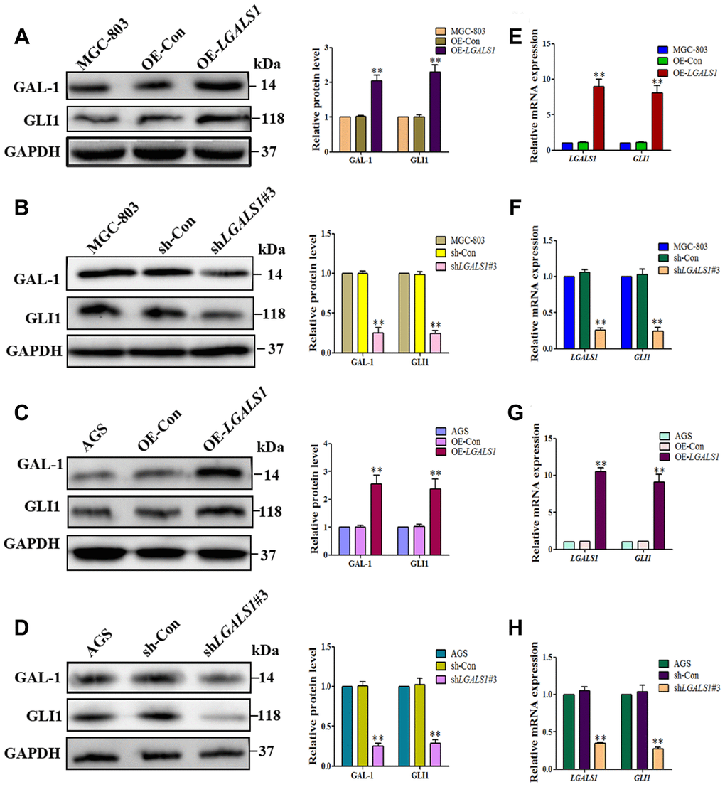 LGALS1 promotes GLI1 expression in vitro. (A and C) Western blotting indicating that OE- LGALS1 efficiently induced GLI1 protein expression compared with wild-type control and negative control-transduced cells. (B and D) Transfection with shLGALS1#3 inhibited GLI1 protein expression compared with wild-type control and negative control-transduced cells. These results were confirmed at the mRNA level by qRT-PCR (E–H). GAPDH served as a loading control. (All n = 3, *P **P 