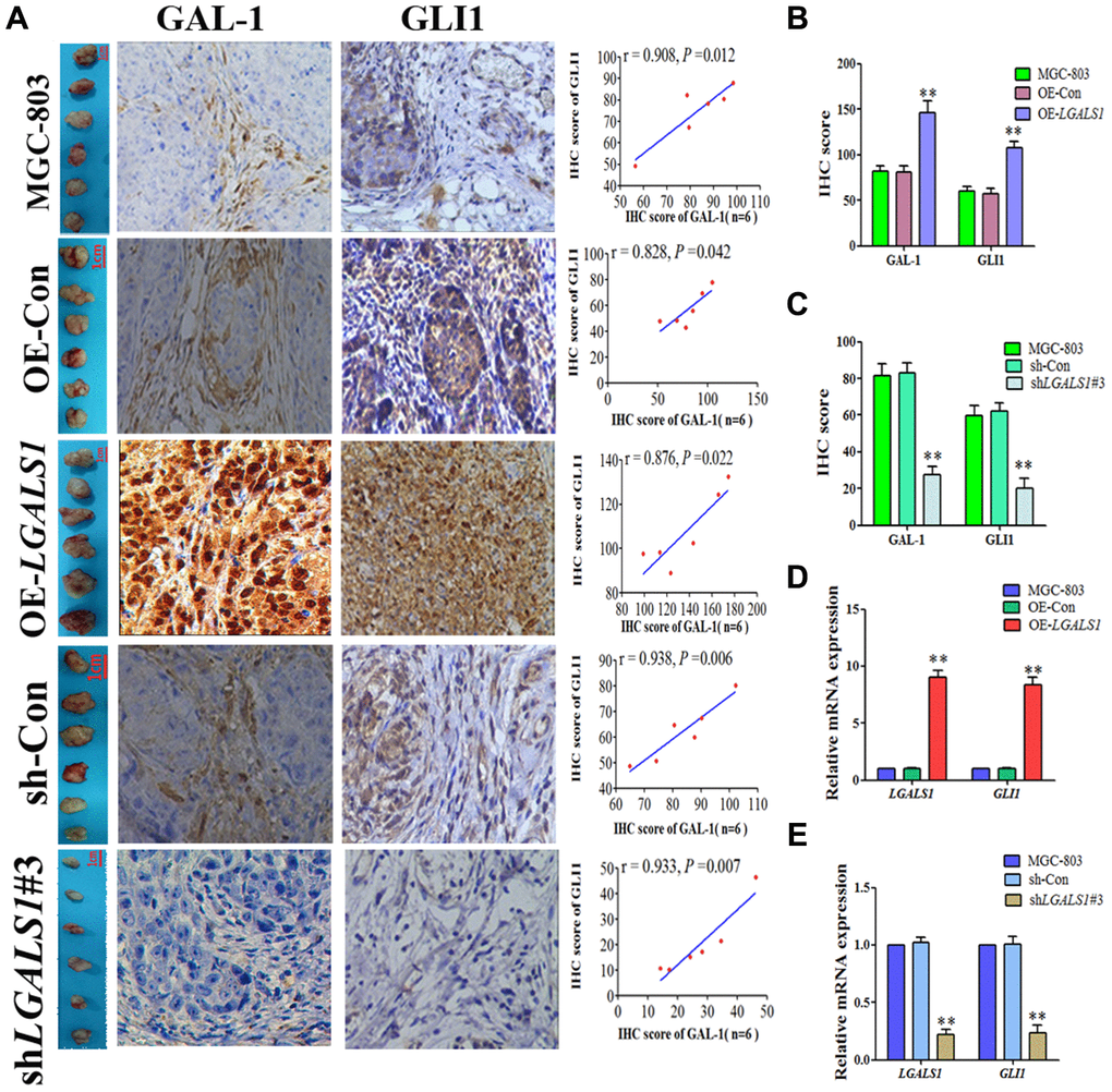 LGALS1 enhances GLI1 expression in vivo. (A) GLI1 and GAL-1 IHC scores were positively correlated in subcutaneous GC tissues from all groups (P B) IHC scores indicating that GLI1 expression was elevated in the OE-LGALS1 group (P C) IHC scores indicating that GLI1 expression was abrogated in the shLGALS1#3 group (P LGALS1 and GLI1 mRNA expression levels in (D) OE LGALS1-transduced and untransduced cells, and (E) shLGALS1#3-transduced and untransduced cells.