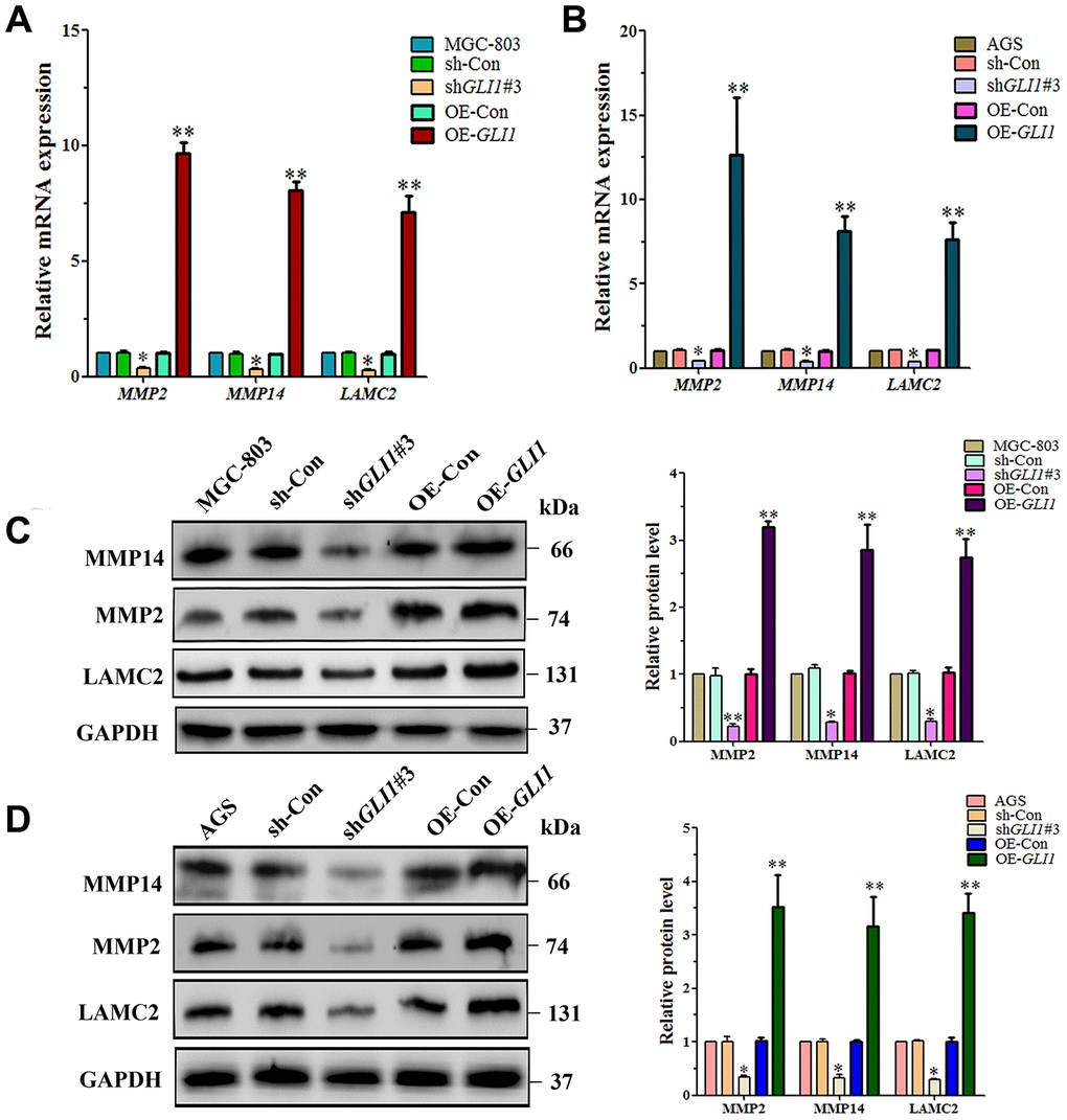 GLI1 affects expression of VM markers - in MGC-803 cells and AGS cells. qRT-PCR analysis of MMP14, MMP2 and LAMC2 mRNA expression in (A) MGC-803 cells, and (B) AGS cells. Western blot analysis of MMP14, MMP2, and LAMC2 protein expression in (C) MGC-803 cells, and (D) AGS cells. (All n=3, *P **P 