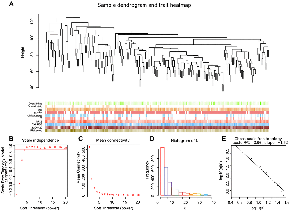 Selecting the appropriate beta value to build the cluster tree. (A) Sample tree and phenotype relation heat map, we selected the cutoff point of 130 and obtained 198 clinical samples. The phenotype includes overall survival, overall state, age, gender, clinical stage, and the expression level of TPX2, TXNRD2 and SLC6A20. The larger the value, the darker the color. (B–E) We built scale-free co-expression networks. The best soft threshold was 5, R-squared = 0.96.