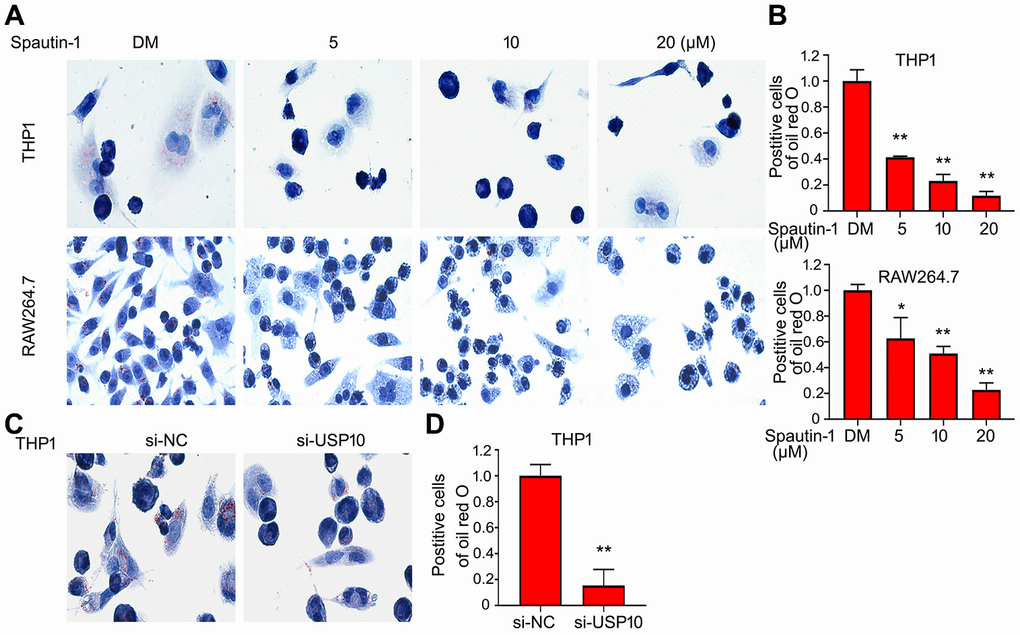 USP10 inhibition or deletion diminishes the formation of foam cell. (A, C) Cells were treated with Spautin-1 or USP10 siRNA and oxLDL (50 μg/ml) for the indicated time. Cell was stained with oil red o. The represent images were showed from three independent experiments. (B, D) The number of stained cells were counted. *pversus each vehicle control.