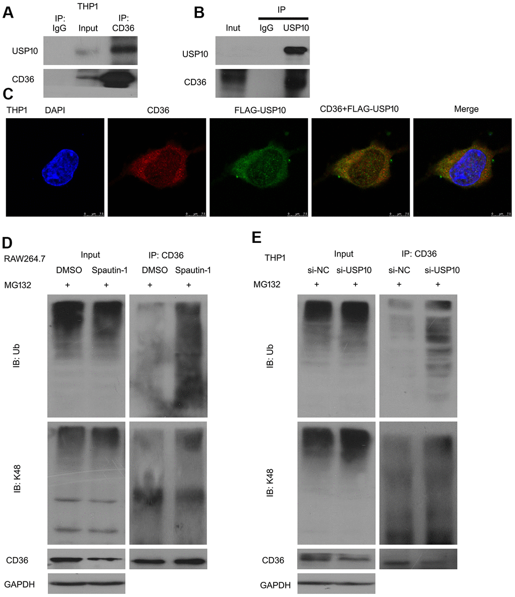 USP10 interacts with CD36. (A, B) Protein lysates were extracted from THP1 cells and subjected to Co-IP assay. (C) Cells were transfected with FLAG-tagged USP10 for 48 h and then stained with FLAG and CD36 antibodies, followed by confocal assay. (D, E) Cells were treated with Spautin-1 or USP10 siRNA. Immunoprecipitated with CD36 beads was subjected to immunoblotted for Ub and K48.
