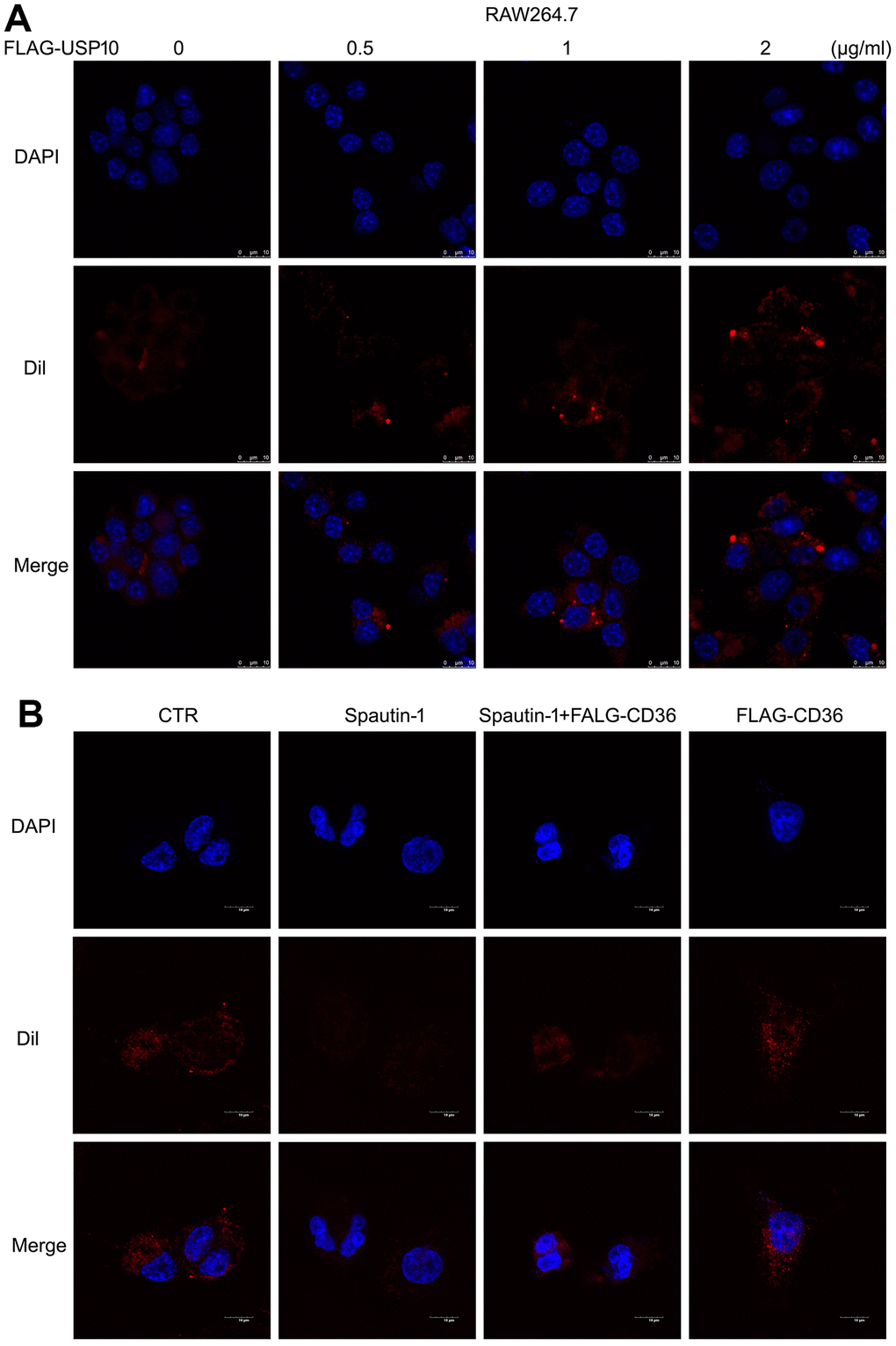 USP10-mediated lipid uptake depends on CD36 expression. (A) Macrophage was transfected with FLAG-USP10 plasmid with different doses for 48 h, followed by Dil-oxLDL for 6 h. (B) Macrophage was treated with Spautin-1 and /or FLAG-CD36 plasmid for 48 h. Dil-oxLDL was added for the additional 6 h. DAPI for cell nucleus. The images were taken by confocal microscopy.