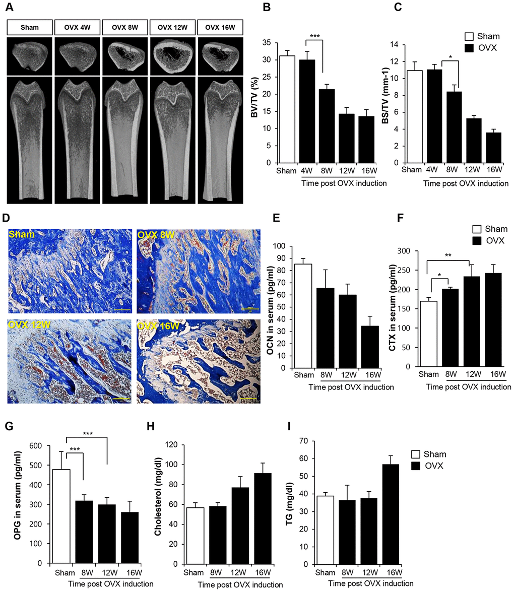 Ovariectomy (OVX) decreases bone density. (A) Representative femoral microcomputed tomography (μCT) images from OVX rats in different time points. (B, C) Quantitative analyses of the trabecular bone fraction of femur from rats. (D) Masson’s Trichrome staining of distal femoral metaphysis sections from rats after sham-operation and OVX. Scale bar: 200 μm. (E–G) Biochemical maker for bone loss were examined. OCN, CTX and OPG expression levels in serum were analyzed by ELISA. (H–I) Cholesterol and TG levels in blood were calculated by ELISA. BV: trabecular bone volume. TV: tissue volume. BS: bone surface. p values of less than 0.05 were considered statistically significant (* p 