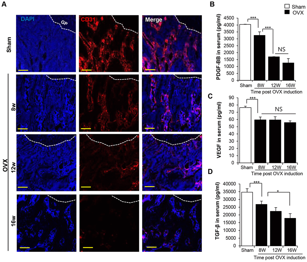 OVX impairs the vasculature in trabecular bone. (A) Images of immunofluorescence staining for CD31 (red) in distal femoral metaphysis from sham-operation and OVX rat. GP: growth plate. Scale bar: 200 μm. (B–D) The concentrations of PDGF-BB VEGF and TGF-β in serum were determined by ELISA. p values of less than 0.05 were considered statistically significant (* p 