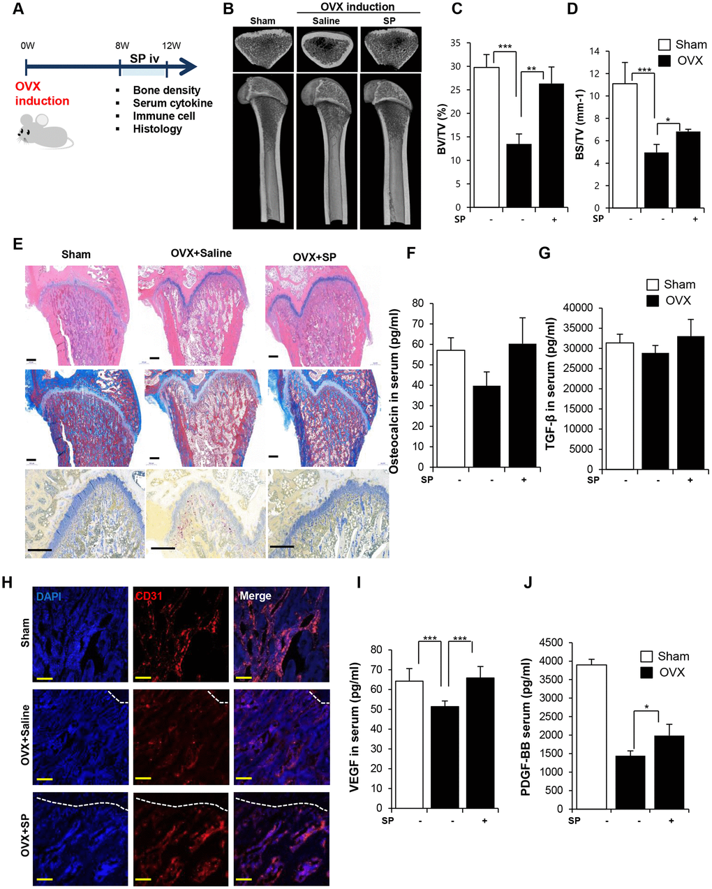 SP ameliorates bone loss, preserving vasculature and angiogenic factors. (A) Experimental schedule for OVX and SP treatment. (B) Representative femoral μCT images. (C, D) Quantitative analyses of the trabecular bone fraction of femora from rats. (E) H&E, Masson’s Trichrome and TRAP staining of distal femoral metaphysis regions. Scale bar: 500 μm. (F, G) The level of osteocalcin and TGF-β in the blood was elucidated by ELISA. (H) Images of immunofluorescence staining for CD31 (red) in distal femoral metaphysis from rat after sham-operation, OVX and OVX with SP treatment. GP: growth plate. Scale bar: 200 μm. (I, J) The concentration of VEGF and PDGF-BB in the blood was analyzed by ELISA. BV: trabecular bone volume. TV: tissue volume. BS: bone surface. p values of less than 0.05 were considered statistically significant (* p 