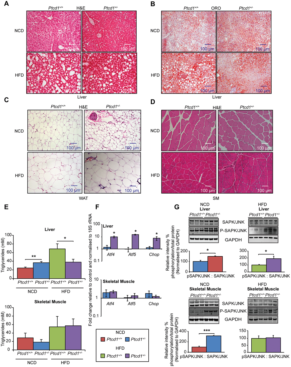 High fat diet can specifically protect the liver from impaired mitochondrial biogenesis by upregulating a transcriptional stress response. (A) Liver sections cut to 10-μm thickness were stained with H&E, from NCD or HFD fed Ptcd1+/+ (n=5) and Ptcd1+/- (n=5) mice. (B) Liver sections cut to 10 μm thickness were stained with Oil red O and hematoxylin, from NCD or HFD fed 17-week-old Ptcd1+/+ (n=5) and Ptcd1+/- (n=5) mice. (C) White adipose tissue sections cut to 5-μm thickness were stained with H&E, from 17-week-old Ptcd1+/+ (n=5) and Ptcd1+/- (n=5) mice fed either a NCD or HFD. (D) Skeletal muscle tissue sections cut to 5-μm thickness were stained with H&E, from Ptcd1+/+ (n=5) and Ptcd1+/- (n=5) mice fed either a NCD or HFD. Scale bars are 100 μm. (E) Triacylglycerol levels were measured in total liver and skeletal muscle isolated from NCD and HFD Ptcd1+/+ (n=9) and Ptcd1+/- (n=9) mice. Mitochondrial transcription factor mRNAs Atf4, Atf5 and Chop were measured in total liver (F) and skeletal muscle RNA isolated from NCD and HFD Ptcd1+/+ (n=5) and Ptcd1+/- (n=5) mice by qRT-PCR and normalized to 18S rRNA. (G) Endogenous levels of SAPK/JNK and its phosphorylated form (Thr183/Tyr185) were determined by immunoblotting of whole tissue lysates from skeletal muscle and livers of 17-week-old Ptcd1+/+ (n=5) and Ptcd1+/- mice (n=5) fed a NCD or HFD. GAPDH (glyceraldehyde-3-phosphate dehydrogenase) was used as a loading control. Relative protein levels and relative intensity percentage of phosphorylation versus total protein levels were measured using ImageJ software and normalized to GAPDH. Error bars are SEM. *P 