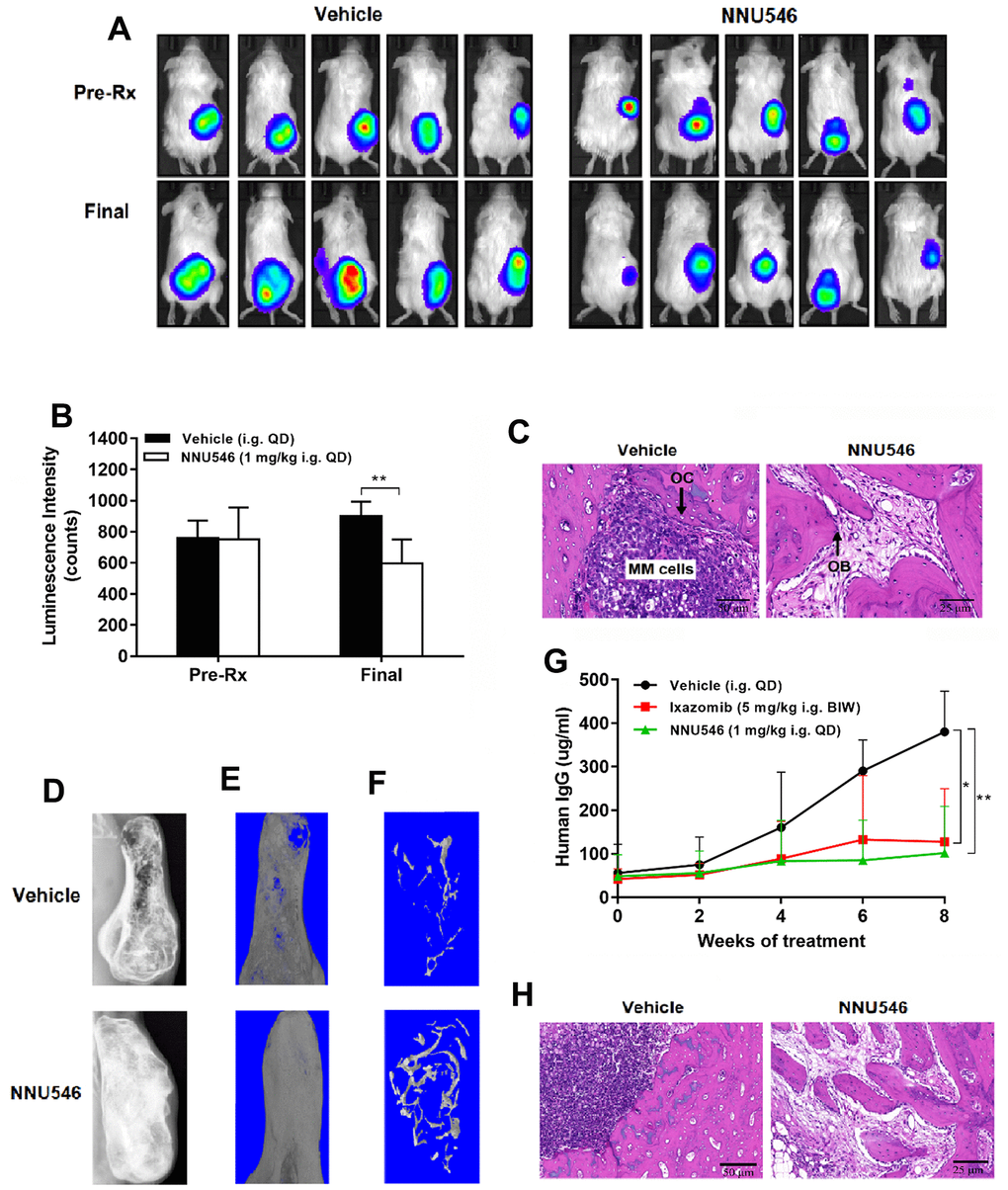 NNU546 inhibits the growth of human MM cells in SCID-rab mouse model. (A) Rabbit bone grafts were subcutaneously implanted into SCID mice. After four weeks, 5×106 of RPMI 8226 cells with luciferase expression were injected directly into the rabbit bone in SCID mice. After establishment of this in vivo model, mice were orally administered with either vehicle or NNU546 (1 mg/kg, QD). Representative imaging of the live animals demonstrated the luciferase expression prior to treatment (Pre-Rx) and at the end of the experiment (Final) in mice. (B) Luminescence intensity was quantified using living animal imaging of mice prior to treatment (Pre-Rx) and at the end of the experiment (Final). Data were expressed as mean ± SD (n=5; **, p C) H&E staining of histological sections of myelomatous bones engrafted with myeloma cells (×200 or ×400 original magnification). Increased myeloma cell infiltration and osteoclast activity were noted in control group. In contrast, myelomatous bone from a host treated with NNU546 had no apparent myeloma cells but possessed increased number of trabecular bone and osteoblast. (D) SCID-rab mice engrafted with myeloma cells from MM patients were treated with vehicle, ixazomib (5 mg/kg, BIW) or NNU546 (1 mg/kg, QD). X-radiographs of myelomatous bones engrafted with myeloma cells from MM patients were performed at the end of the experiment. (E, F) Representative microCT images of bone grafts excised from vehicle-treated animals and mice that had received NNU546 for 8 weeks. (G) Effect of therapy on myeloma growth assessed by human IgG levels in the mouse serum measured by ELISA. Data were shown as mean ± SD (n=5; *, p p H) H&E staining of histological sections of myelomatous bones engrafted with cells from MM patients (original magnification, ×200 or ×400 original magnification).