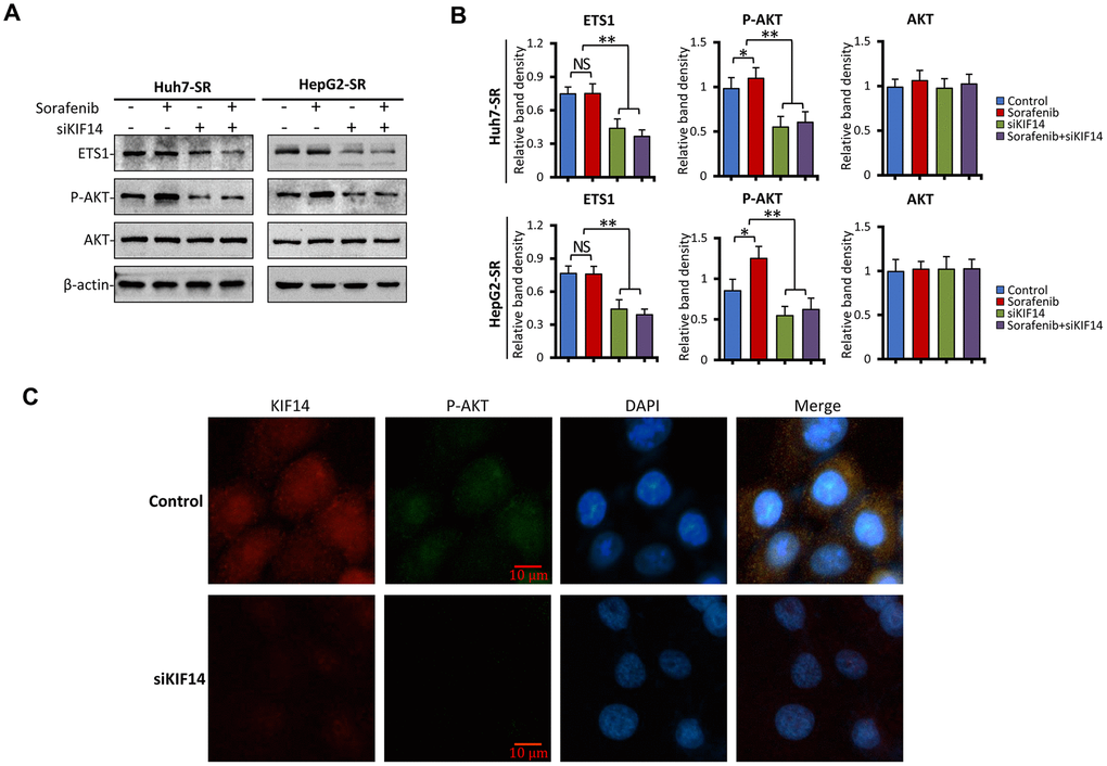 KIF14 silencing inhibits the AKT–ETS1–KIF14 positive feedback loop to reverse acquired resistance to sorafenib in HCC. (A and B) Sorafenib-resistant Huh7-SR and HepG2-SR cells were transfected with control or siKIF14 for 24 h and subsequently incubated with 0 or 5 μM sorafenib for 24 h. The protein expression profiles of ETS1, AKT, and p-AKT were detected by western blotting (A). The density of each band was normalized to that of β-actin (B). (C) Control or siKIF14-transfected Huh7-SR cells were stained with anti-KIF14 Ab (red), anti-p-Akt Ab (green), and DAPI (cellular nuclei, blue) and viewed with an inverted fluorescence microscope. Data represent three independent experiments. Scale bar = 10 μm. NS, not significant. “*” Indicates P