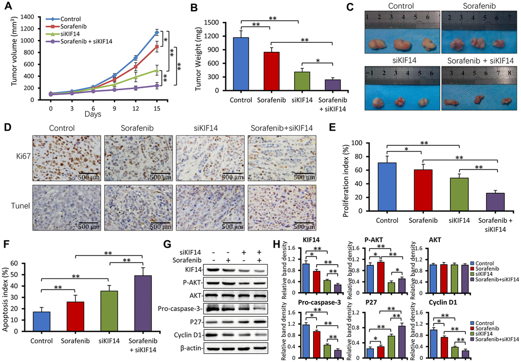 KIF14 silencing synergizes with sorafenib to suppress subcutaneous tumors formed from sorafenib-resistant cells in vivo. (A) Subcutaneous tumors were established in mice that received different treatments for 15 days as described in the Materials and Methods section. The volume (mm3) of tumors was recorded. (B and C) Tumors harvested at the end of experiments were weighed (B) and photographed (C). (D) Representative images of tumor sections stained with anti-Ki-67 Ab (top) and subjected to TUNEL assay (bottom; magnification, ×200). (E) The proliferation index (%) and (F) apoptosis index (%) were quantified. (G and H) Western blotting of lysates of tumors harvested from (A) at the end of experiments (G). The density of each band was normalized to that of β-actin (H). Scale bar = 500 μm. “*” Indicates P