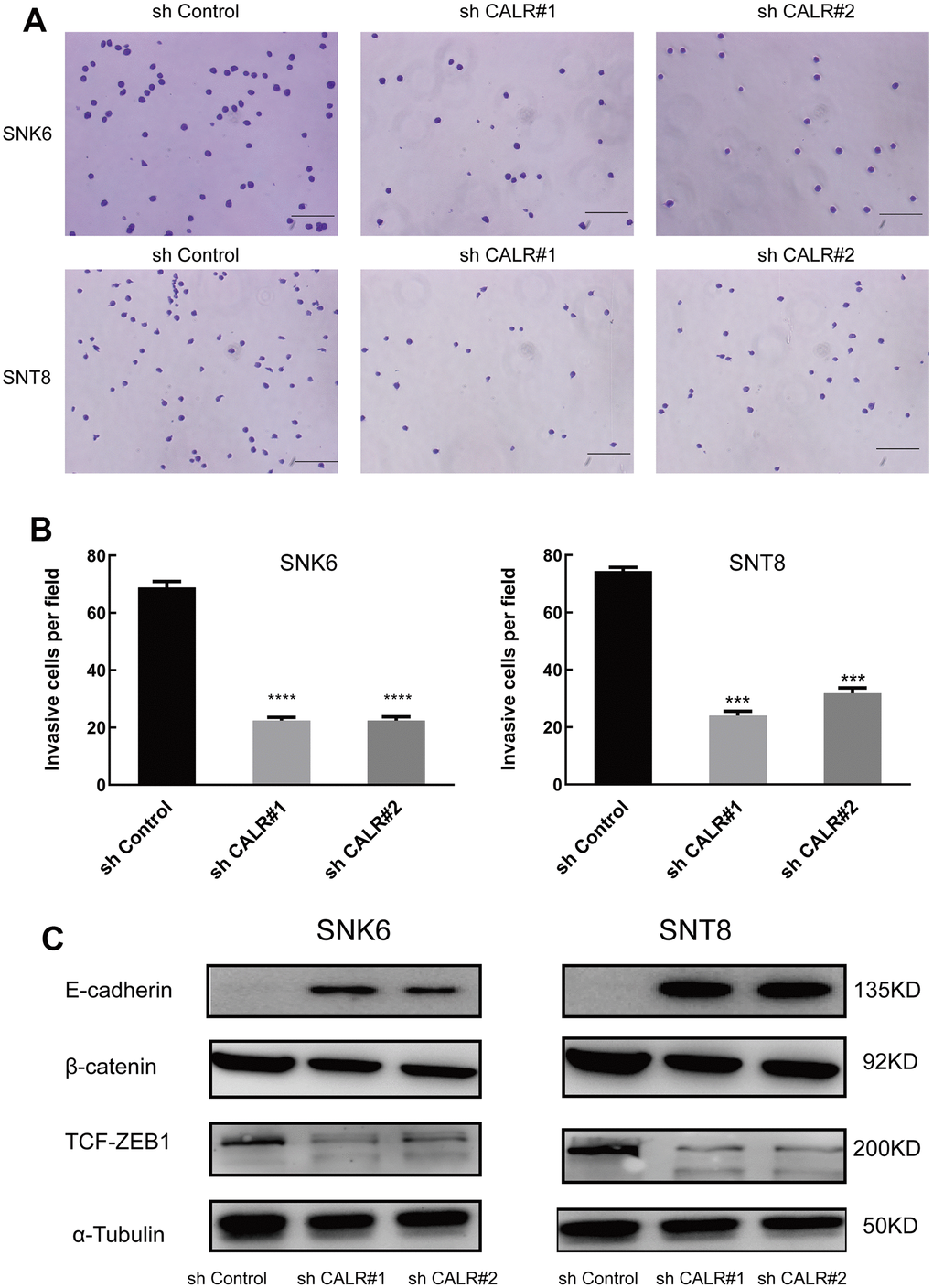 CALR knockdown suppresses in vitro transwell migration and EMT in NKTCL cells. (A, B) Transwell migration assay results show the numbers of migrating cells in the control and CALR-knockdown SNK6 and SNT8 cells (bar=200μm). Note: The data are shown as means ± standard deviation; **** P P C) Western blot analysis shows the expression of EMT-related proteins, E-cadherin, β-catenin, and TCF-ZEB1, in the control and CALR-knockdown SNK6 and SNT8 cells, and α-tubulin was used as the loading control.