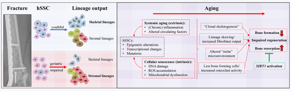 Summary of human skeleteal stem cell based age-related alterations leading to bone loss and impaired regenerative capacity. A young functional hSSC is clonally diverse and abundantly gives rise to cell of the skeletal lineages as well as bone marrow supporting stroma. During aging lineage output is skewed which could underlie cellular senescence due to chronological aging or changes forced by an altered microenvironment. Future studies have to explore if aging of hSSCs, similar, to hematopoiesis, leads to clonal expansion of clones with specific characteristics, e.g. preferred fibroblast lineage generation. As a consequence of shifted differentiation to specific stromal lineages not only bone formation is impaired but also bone resorption is increased. Some of these changes might be the consequence of the loss of SIRT1 expression and reactivation could be a potent therapeutic means to restore youthful hSSC function and thereby reverse age-related bone loss.