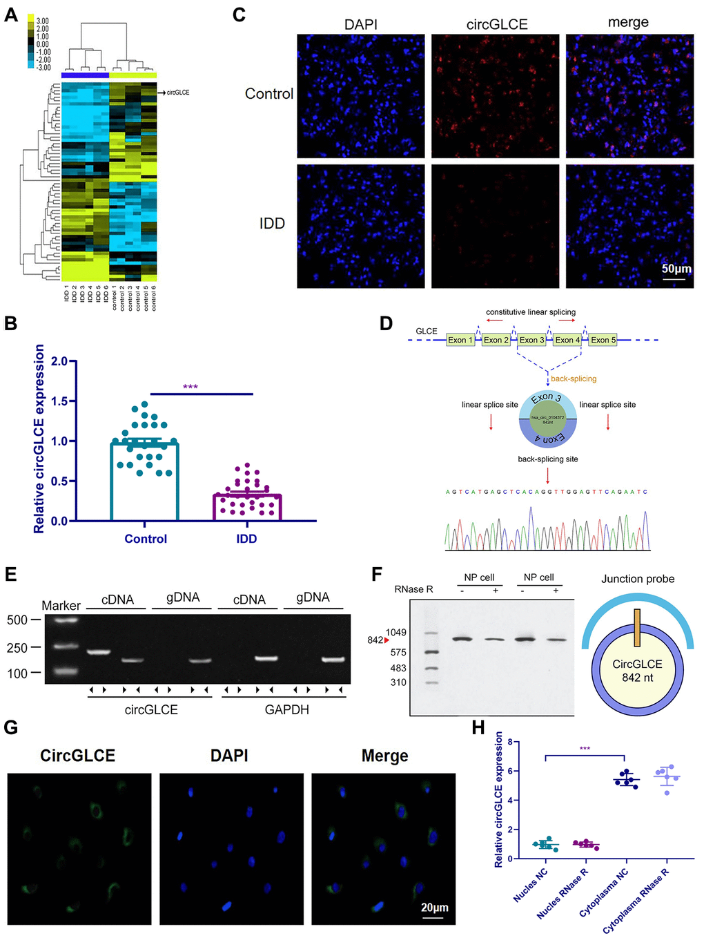 CircGLCE expression in IDD and normal NP tissue samples. (A) Heat map of all differentially expressed circRNAs between the IDD sample and the paired controls. (B) The comparison of CircGLCE expression between 31 degenerative NP samples and 26 controls, which was quantified with RT-qPCR (***P C) The CircGLCE level was measured by FISH, and it also showed a significant decrease in the levels in degenerative NP samples compared to controls. (D) Schematic illustration showing the circularization of GLCE exons 3-4 from circular RNA. The Sanger sequencing of CircGLCE relied on the validation of content by RT-qPCR. (E) CircGLCE was amplified by divergent primers with cDNA. (F) CircGLCE showed RNase R resistance in northern blotting. The length of CircGLCE was 842 nt. The probe targeted the junction. (G) The FISH results demonstrated the presence of CircGLCE in the cytoplasm of NP cells. (H) The results of RT-qPCR confirmed the presence of CircGLCE in the cytoplasm of NP cells (n=6, *** P