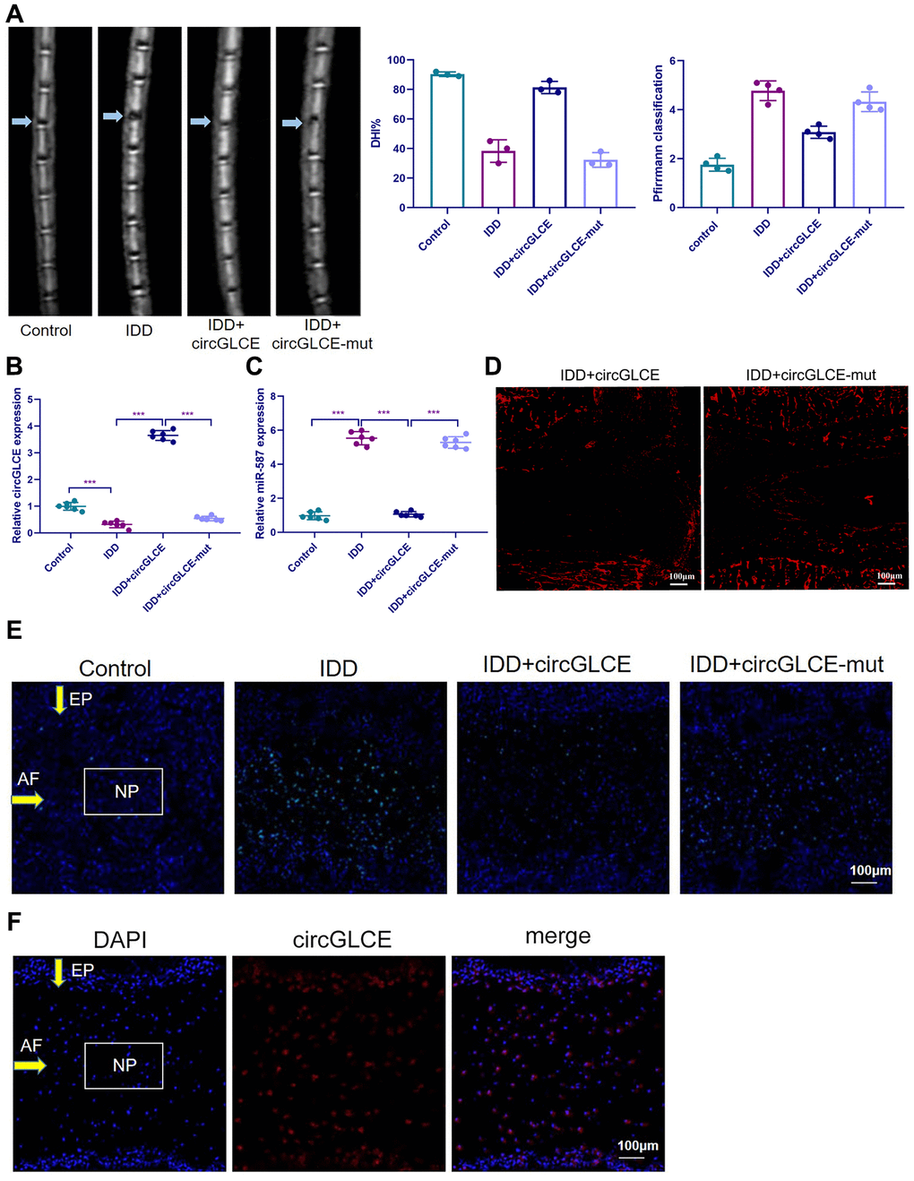 Overexpressed CircGLCE alleviates IDD in vivo. 12 weeks after the induction of IDD and the administration of treatments, (A) MRI was performed and images were obtained; the disc height indices after (n=3, *** PB) RT-qPCR results indicated the CircGLCE levels corresponding to induced IDD and CircGLCE treatments (n=6, ***P C) the expression of miR-587 was downregulated by overexpressing CircGLCE in an animal model of induced IDD, as shown with RT-qPCR (n=6, ***P D) Cy3-tagged circGLCE NPs analysis. (E) TUNEL staining revealed the in vivo effect of overexpressed CircGLCE on apoptosis after 12 weeks. (F) RNA FISH illustrated the in vivo distribution of CircGLCE in NP tissue.