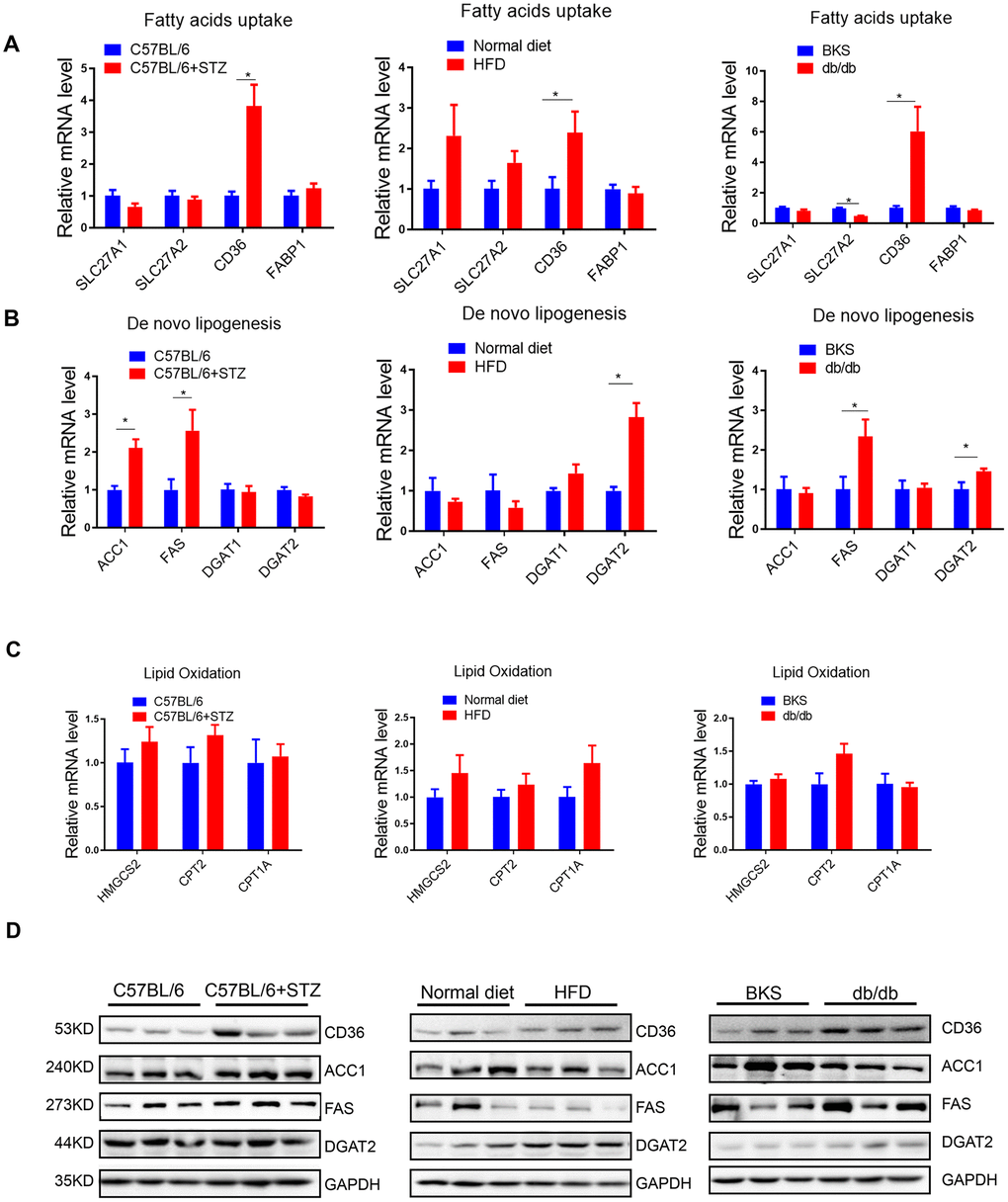 Fatty acids uptake and lipogenesis in liver of differently treated mice. (A–C) Quantitative real-time PCR was performed to determine the hepatic mRNA levels of fatty acids uptake-, de novo lipogenesis- and lipid oxidation related genes in STZ-treated C57BL/6 mice, HFD-treated C57BL/6 mice and db/db mice (n=6, *pD) Western blot was used to analyse the hepatic protein levels of fatty acids uptake-, de novo lipogenesis- and lipid oxidation related genes in STZ-treated C57BL/6 mice, HFD-treated C57BL/6 mice and db/db mice (n=3).