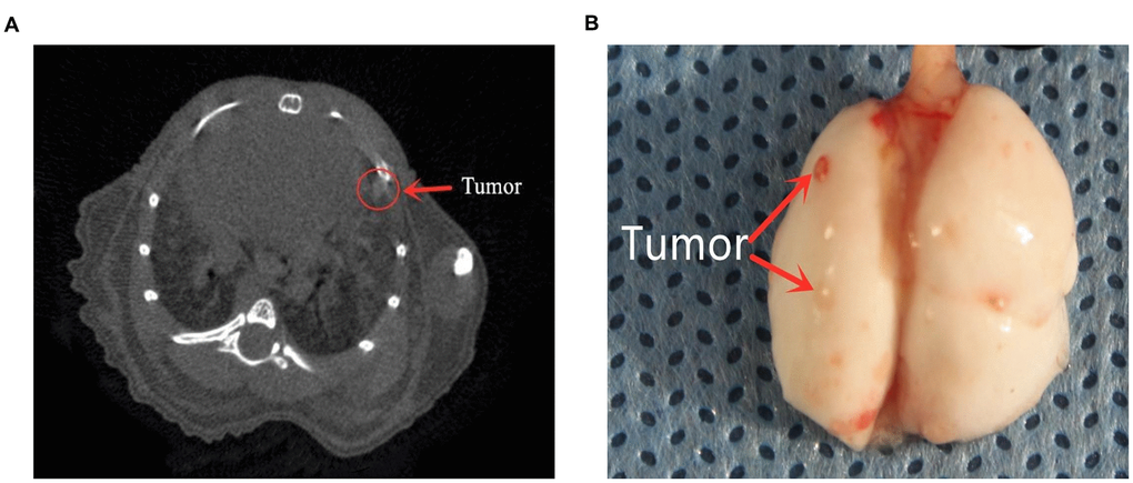 The formation of lung metastases. (A) Representative images of micro-CT scans. Metastatic tumors can be seen. (B) Lung photograph from one mouse. Red arrows indicate metastatic nodules.