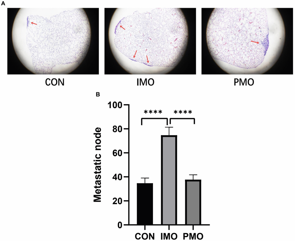 PMOs inhibited the metastasis of osteosarcoma. K7M2 WT cells were injected into the tail veins of mice in the control, IMO and PMO groups, and metastatic nodules in the lungs were quantified. (A) H&E staining of lung tissues from each group. Representative images are shown. (B) The number of metastatic nodules was counted. ****, P