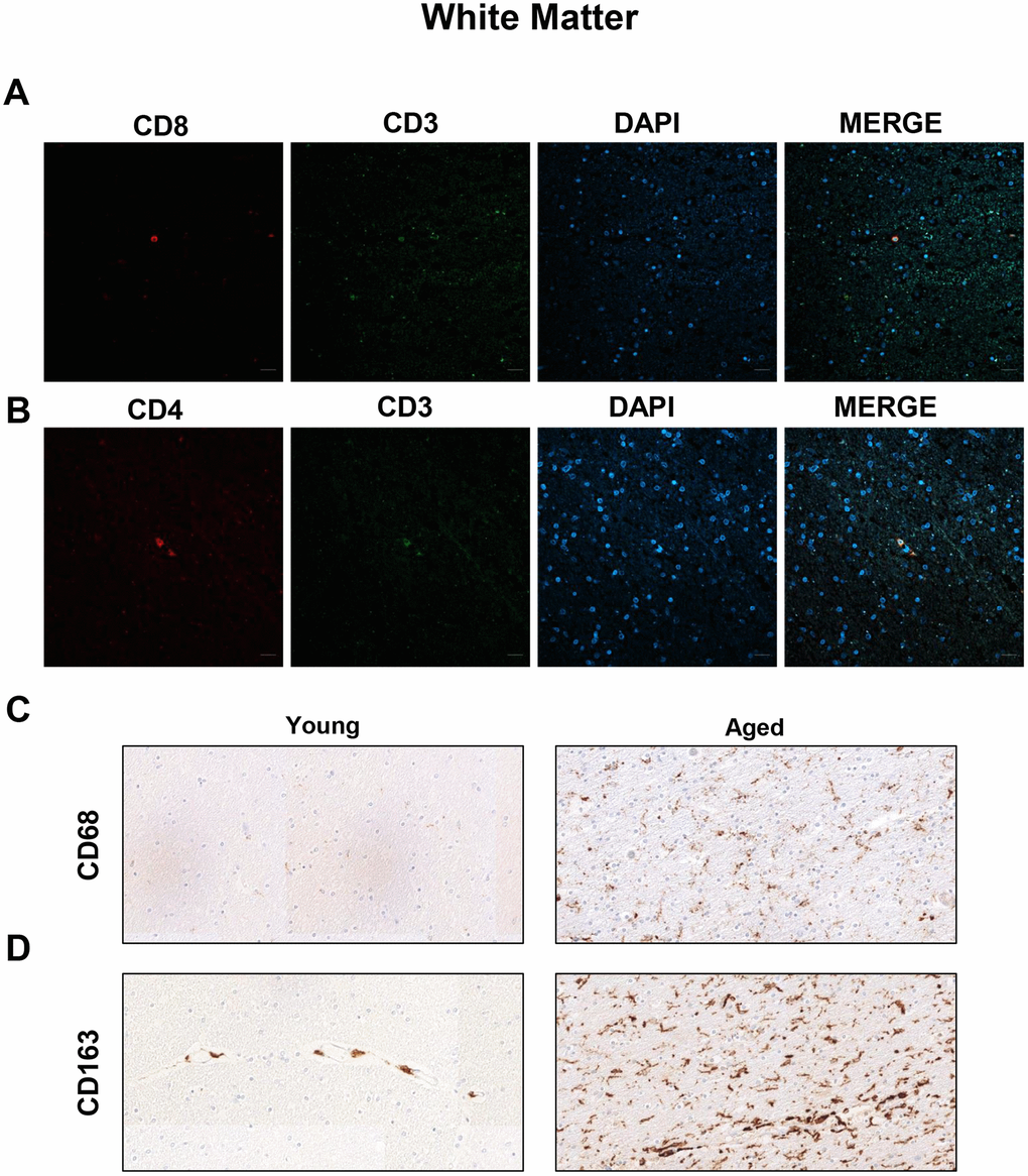 Presence of cytotoxic CD8+ T cells in the white matter of aged individuals. (A) Co-immunofluorescence of CD8 with CD3 marker (n=4). (B) Co-immunofluorescence of CD3 with CD4 marker (n=4). Cell nuclei were counterstained with DAPI. Scale bar: 20 μm. (C, D) Representative images of CD68 and CD163 microglia markers in young and aged individuals (n=3). Images appear to be spliced likely consequence of scanning and were obtained using the 20× objective.