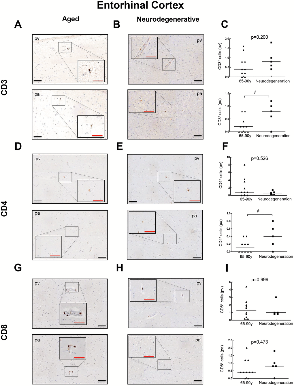 Comparison of CD3+, CD4+ and CD8+ cells with pathological aging in entorhinal cortex. Representative images and quantification of CD3 (A–C), CD4 (D–F) and CD8 (G–I) expression in aged individuals and patients with neurodegenerative disease. Data are presented as number of positive cells per mm2 with median bar. Red scale bar: 50 μm; black scale bar: 100 μm. Entorhinal cortex (EC), perivascular region (pv), brain parenchyma (pa).