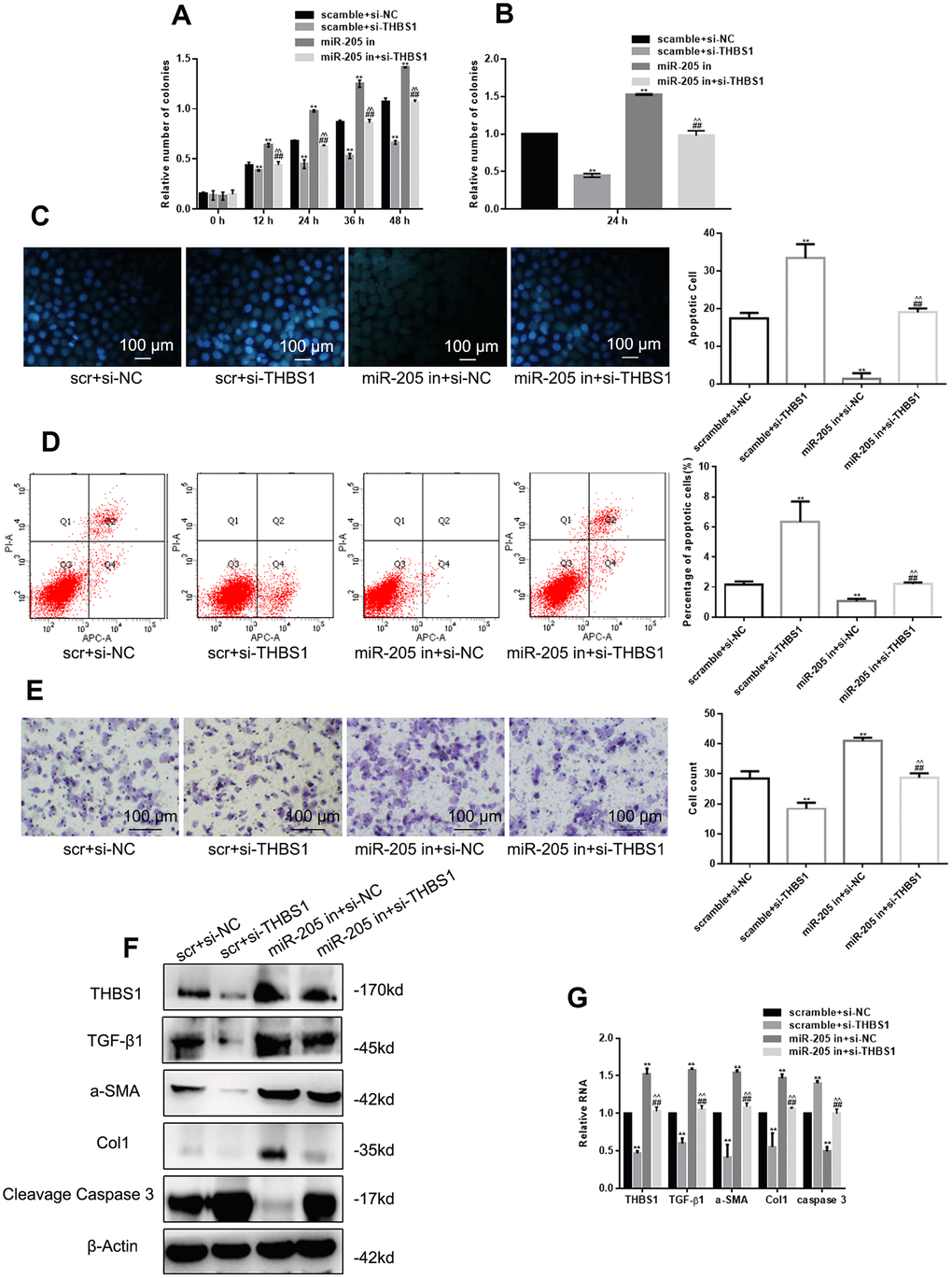 miR-205 inhibitor can restore the effect of si-THBS1 overexpression on cells. (A, B) The viability of the indicated cells was detected by MTT assay and colony formation assay. (C, D) The apoptosis of the indicated cells was detected by Hoechst 33258 and Annexin V-PI assay. (E) The indicated cell migration was measured by Transwell assay. (F, G) The expression of the indicated genes was measured by Western blot and real-time PCR, respectively. **P 