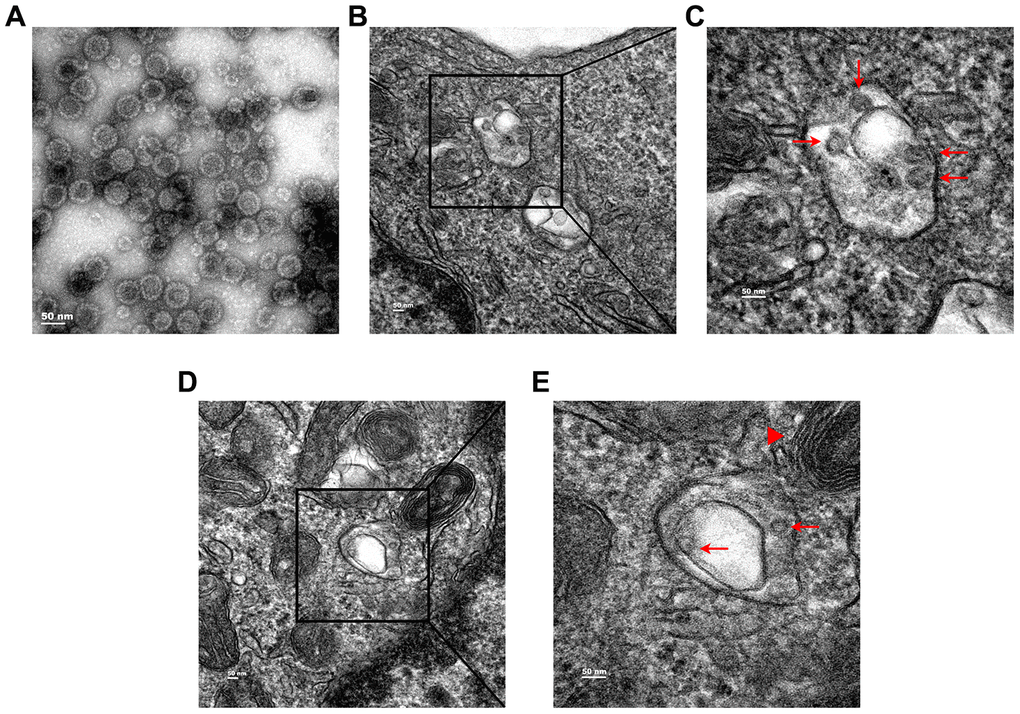 Transmission electron microcopy (TEM) analysis of subcellular localization of HPV11 PsV particles in NHEK cells. (A) TEM images of purified HPV11 PsV particles. (B, C) HPV11 PsV particles appear in the lumen of double-membrane vesicle. (D, E) Engagement of HPV11 PsV particles-containing autophagosome by a lysosome. Arrows indicate HPV11 PsV particles and the triangle indicates a lysosome.