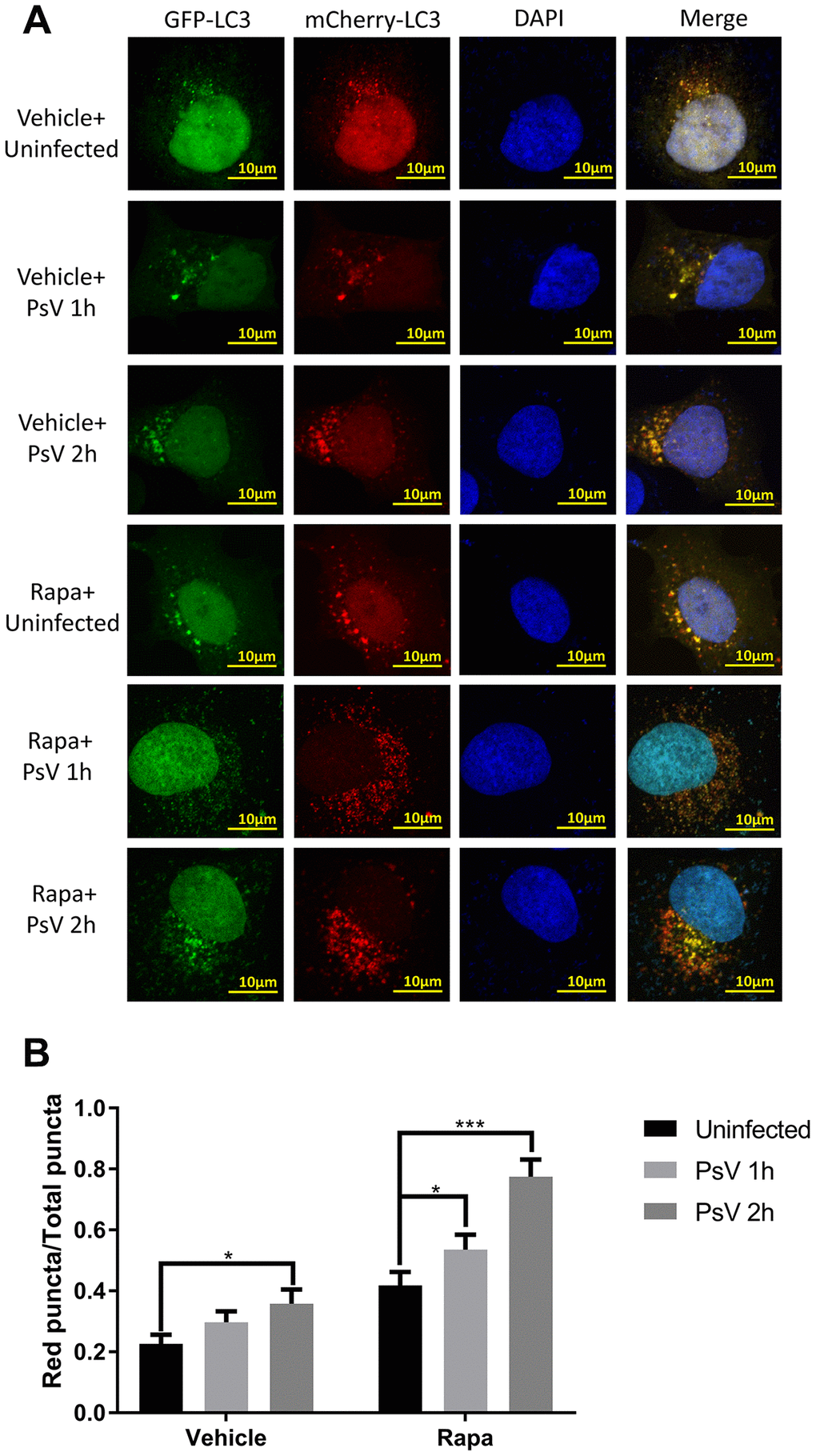 Autolysosome formation is induced by HPV11 PsVs upon entry of NHEKs and enhanced by rapamycin. (A) Confocal microscopy analysis of HPV11 PsV-infected NHEKs transfected with the mCherry-GFP-LC3 plasmid. Experiments were performed with or without pre-treatment with the canonical autophagy activator rapamycin. (B) Quantification of the ratio of red puncta (autolysosomes) to all puncta (autophagosomes plus autolysosomes). The graph represents the mean and standard deviation from three biological independent repeats, and at least 100 cells were analyzed per repeat. Significant differences were identified by Student’s t test. *, P 