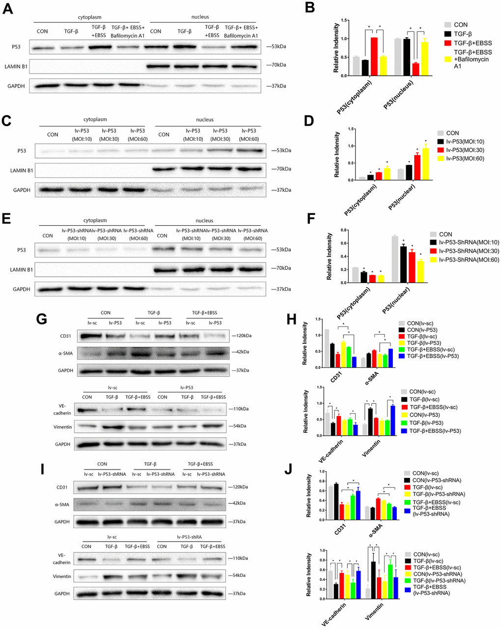 MEndT was modulated by autophagy by regulating the expression of nuclear p53. Cells were treated with TGF-β and EBSS as described above. (A, B) p53 expression in the cytoplasm and nucleus was evaluated by Western blot. (C, D) Cells were infected with lv-p53 for 24 h, and infection was assessed by the expression of p53. (E, F) p53 expression in cells treated with lv-p53-shRNA. (G, H) After overexpressing p53, cells were treated by the method described above, CD31, VE-cadherin, Vimentin and α-SMA levels were analyzed by immunoblot. (I, J) CD31, VE-cadherin, Vimentin and α-SMA expression in cells treated with lv-p53-shRNA using the method described above. Bar graphs represent data from three independent experiments and data represent the means±SEM. Unpaired T test (*P